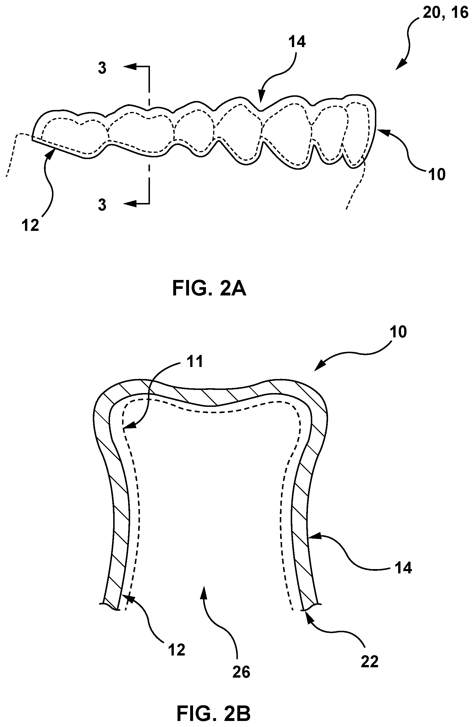 Patent US12616557 Figure 2 – Systems and methods for determining an edge of orthodontic appliances