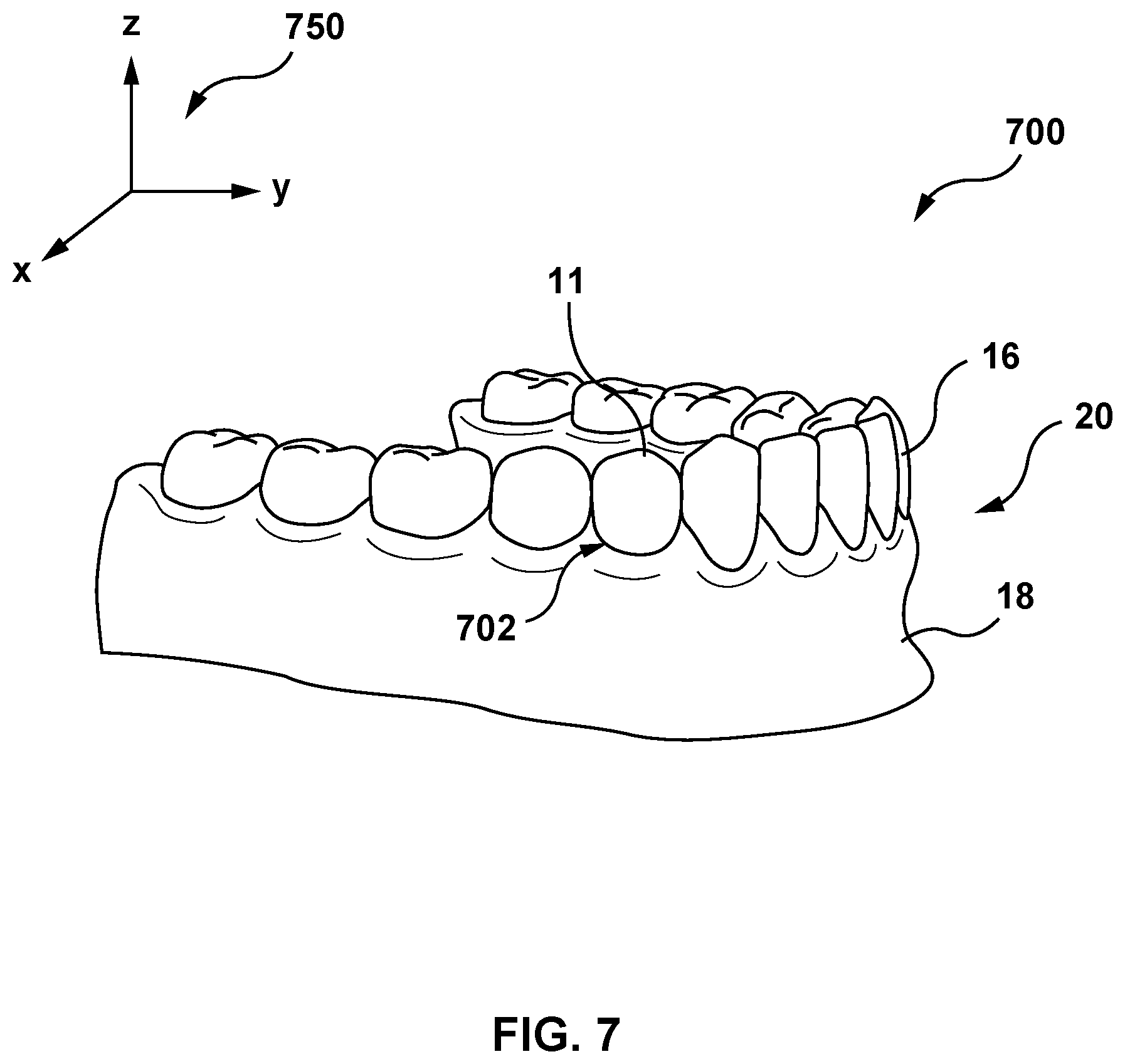 Patent US12616557 Figure 6 – Systems and methods for determining an edge of orthodontic appliances