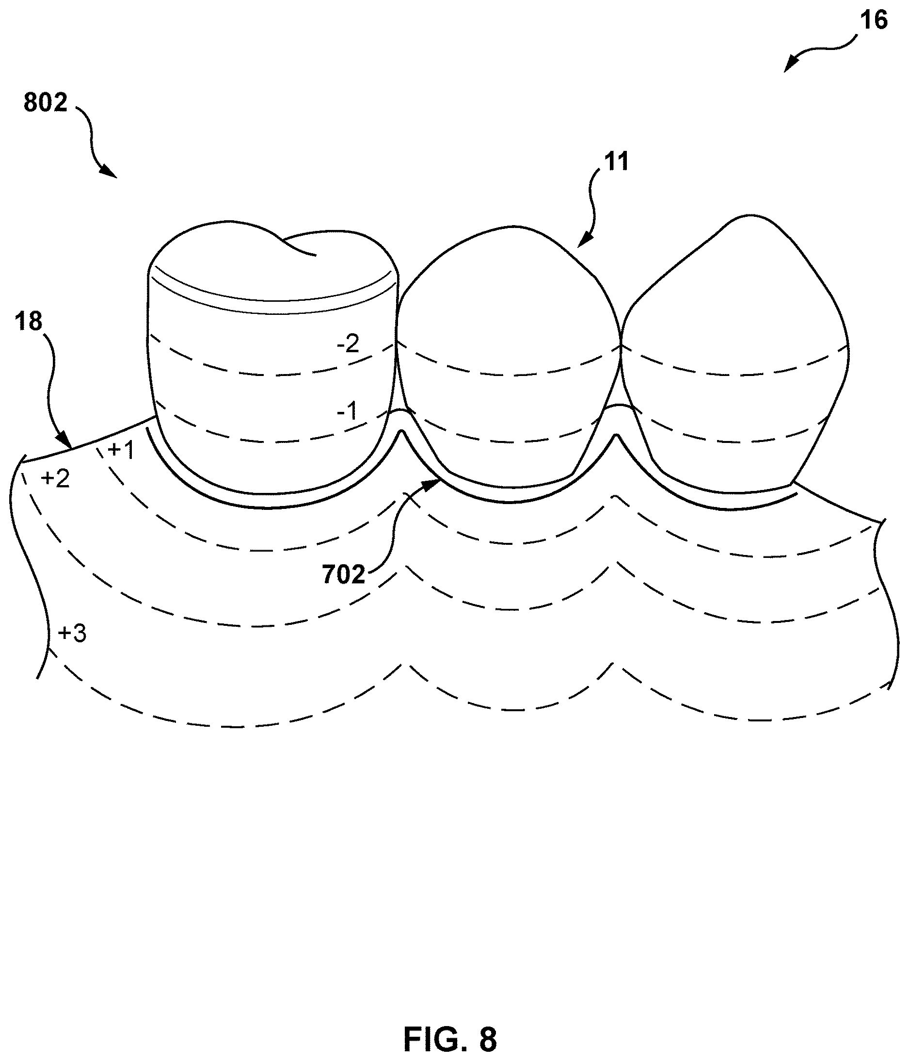 Patent US12616557 Figure 7 – Systems and methods for determining an edge of orthodontic appliances