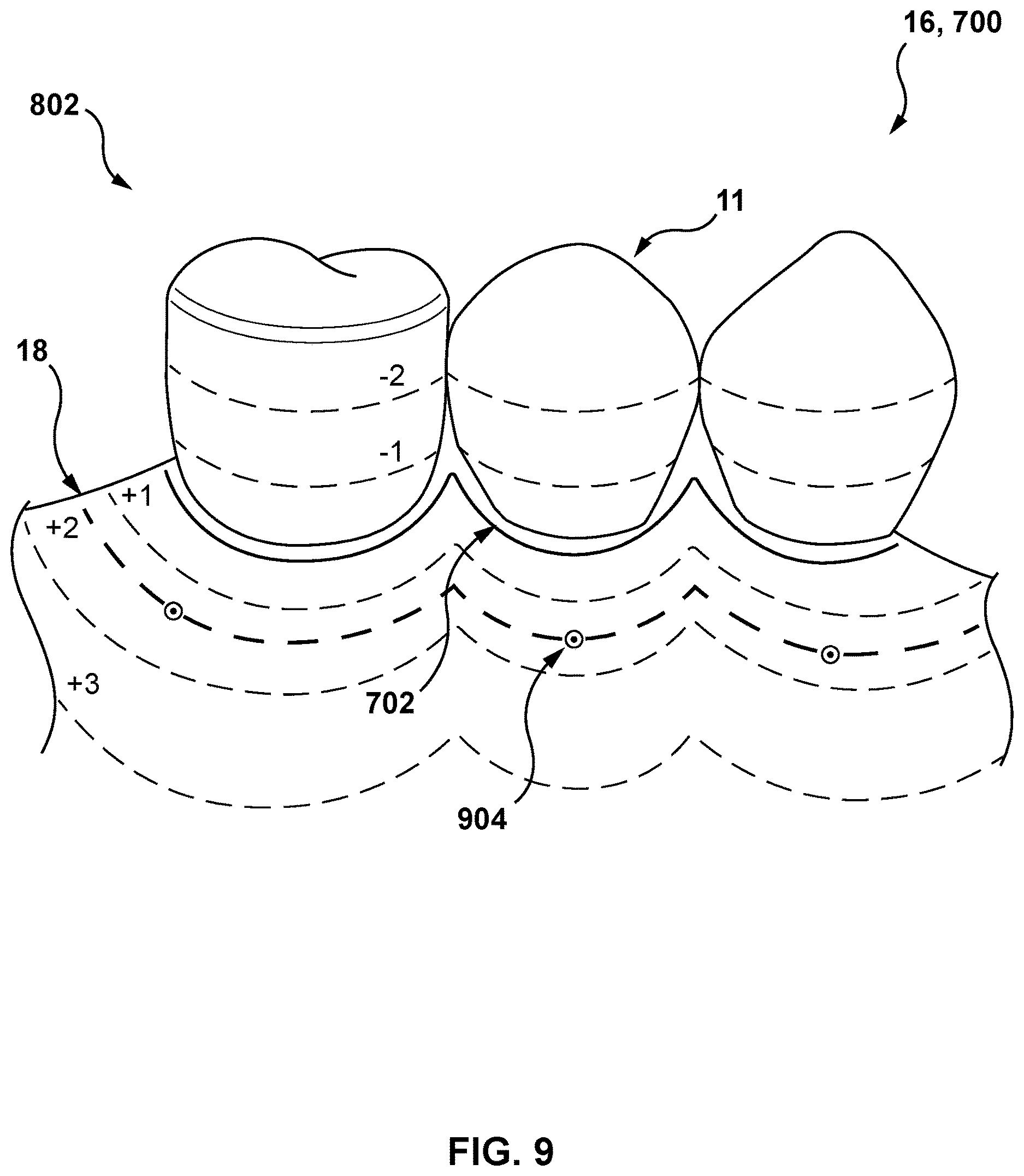Patent US12616557 Figure 8 – Systems and methods for determining an edge of orthodontic appliances