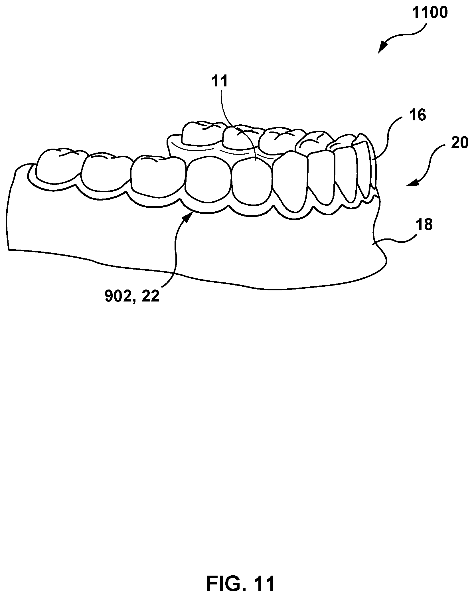 Patent US12616557 Figure 10 – Systems and methods for determining an edge of orthodontic appliances