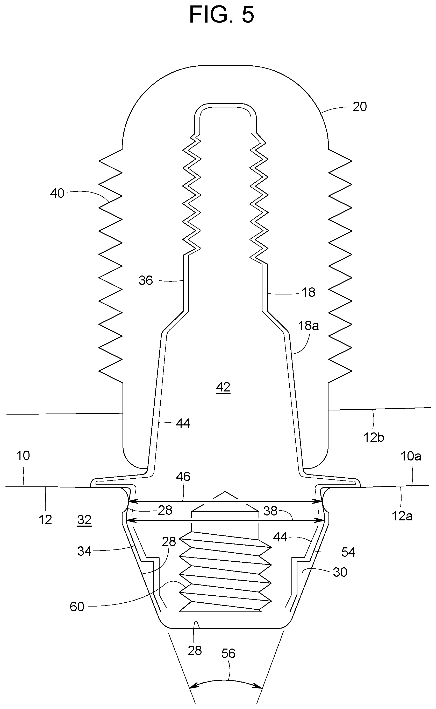 Patent US12616558 Figure 3 – Direct-snap dental abutment systems