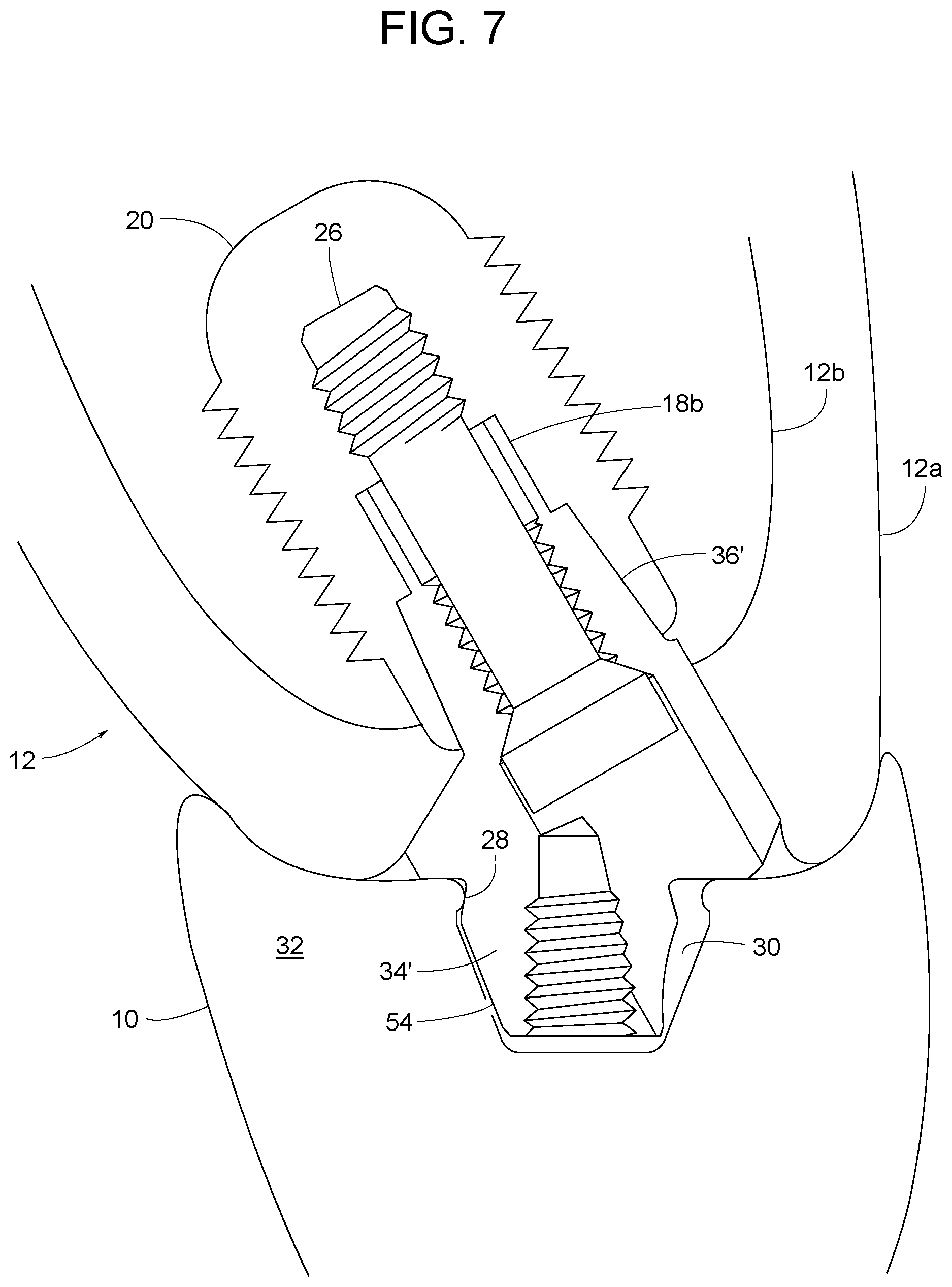 Patent US12616558 Figure 5 – Direct-snap dental abutment systems