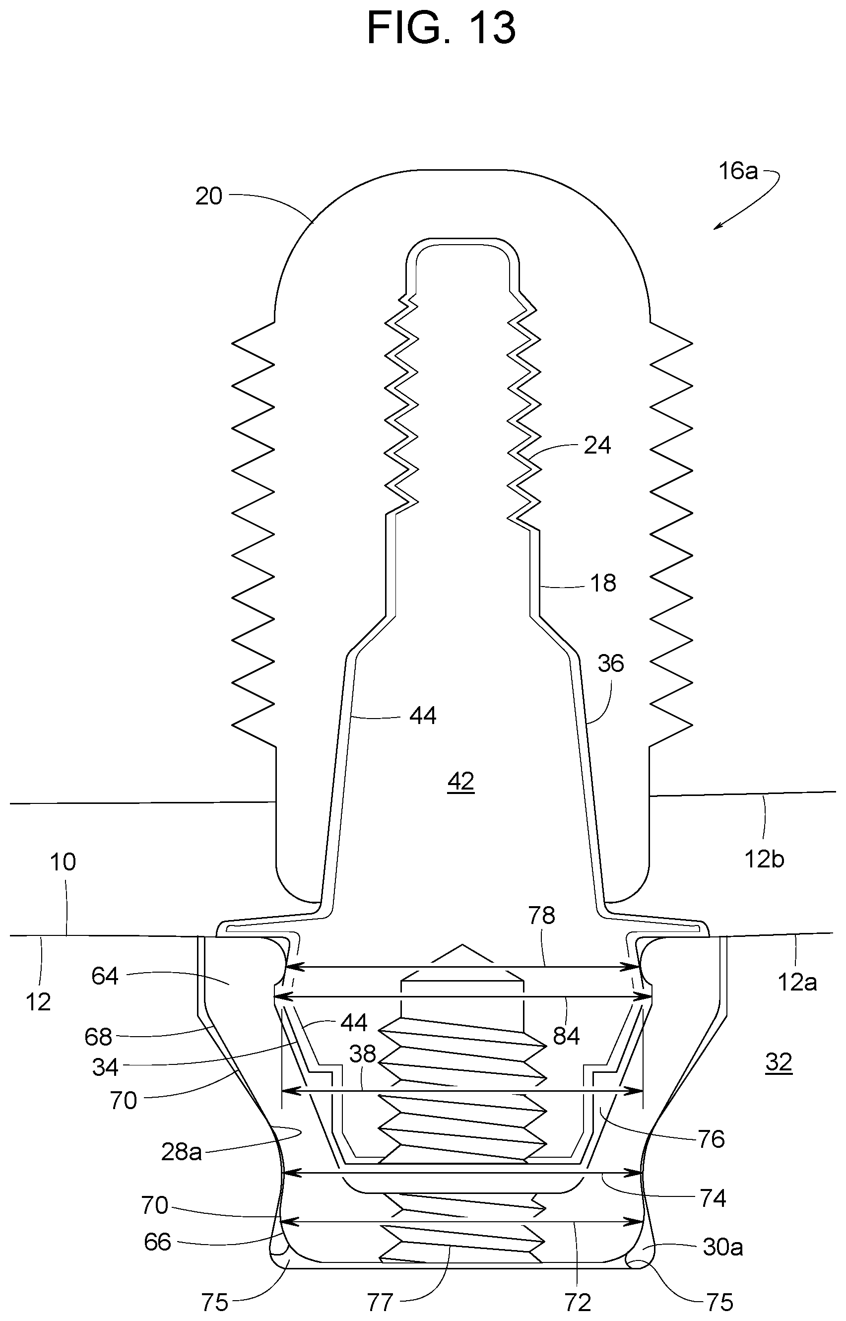 Patent US12616558 Figure 11 – Direct-snap dental abutment systems