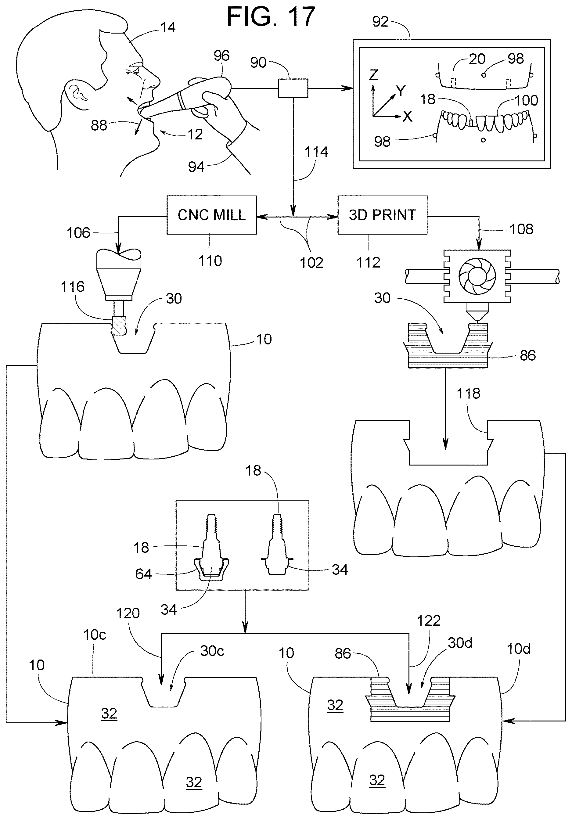 Patent US12616558 Figure 13 – Direct-snap dental abutment systems