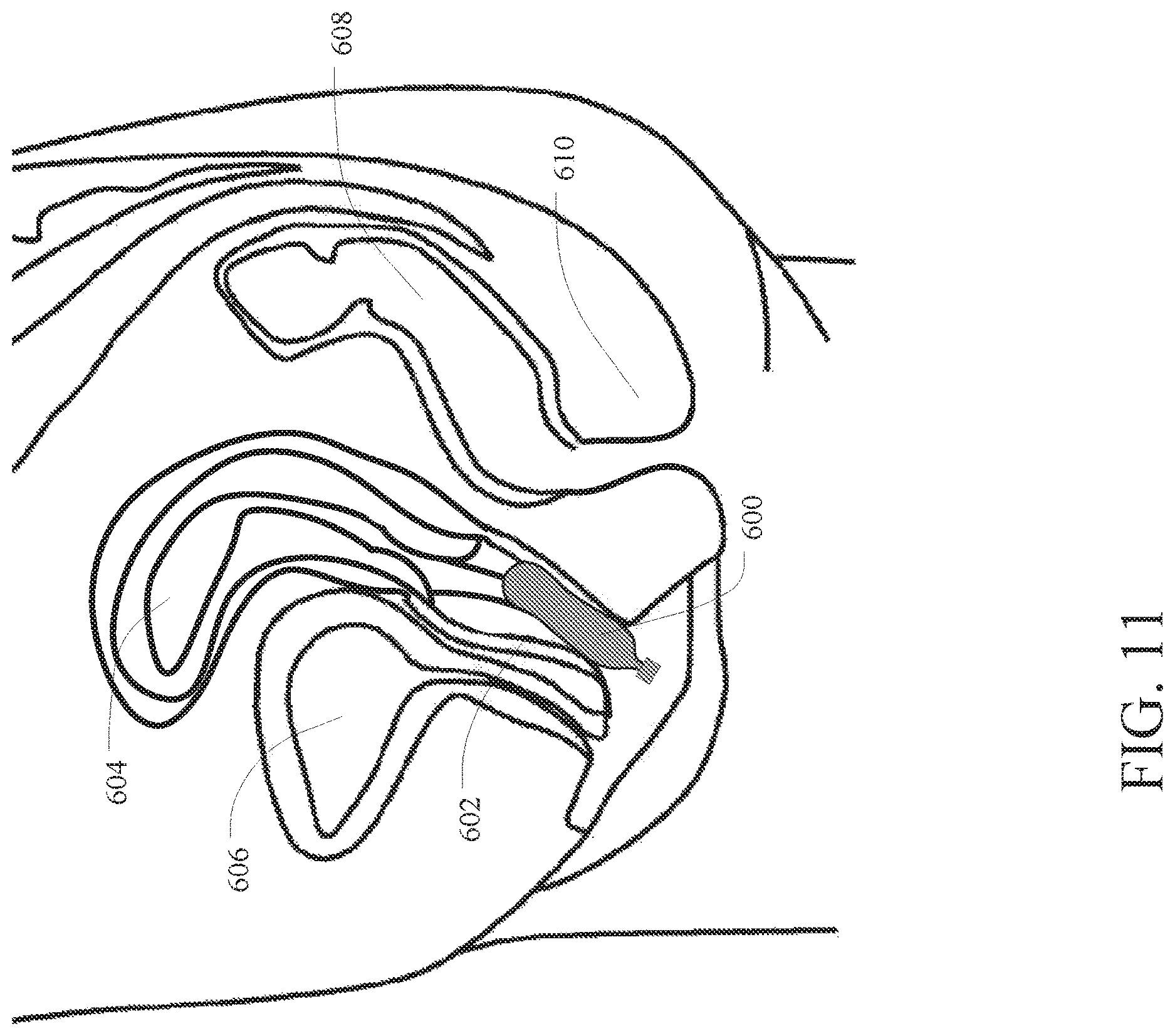 Patent US12616562 Figure 9 – Systems and methods for continence training