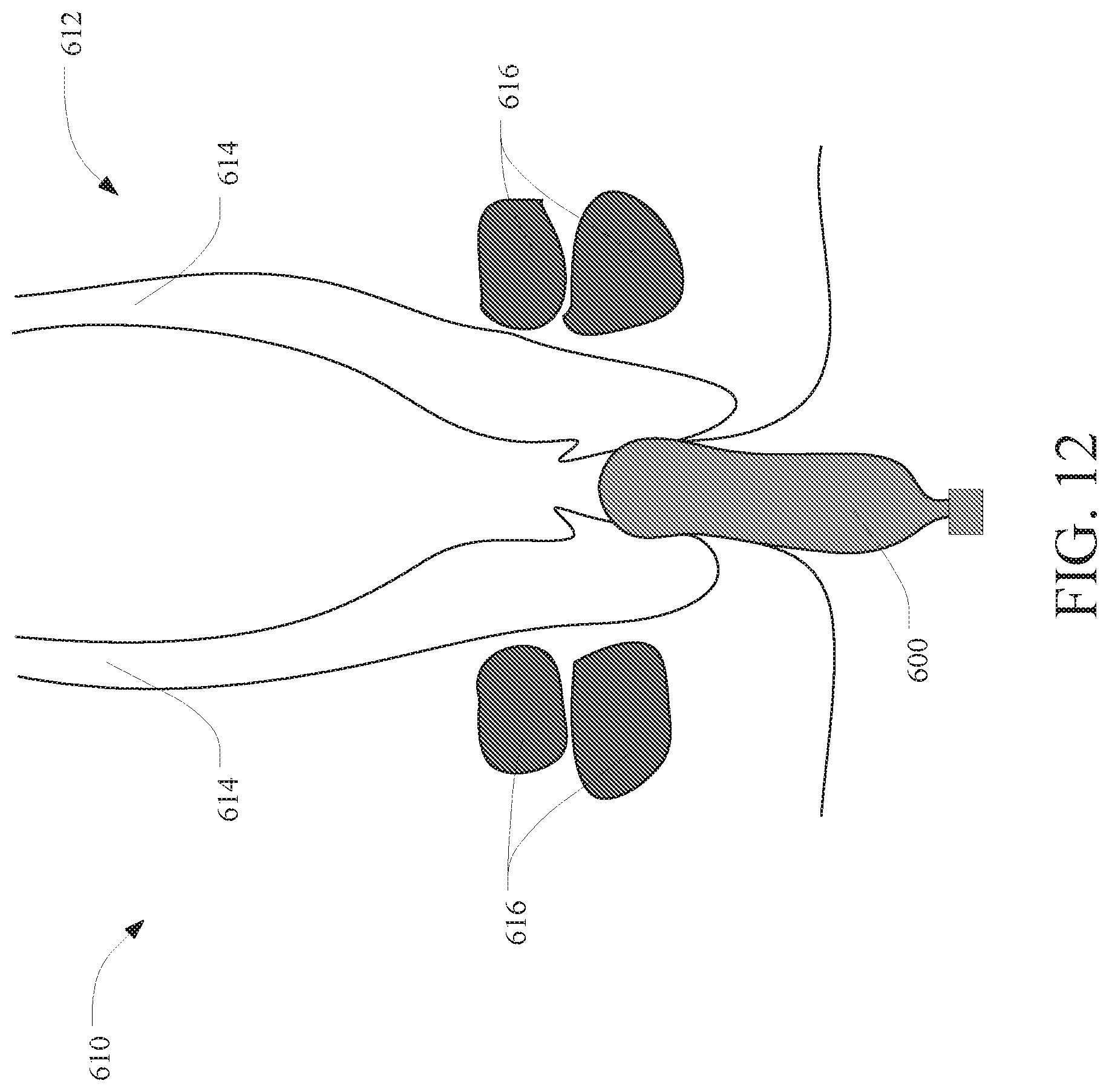 Patent US12616562 Figure 10 – Systems and methods for continence training