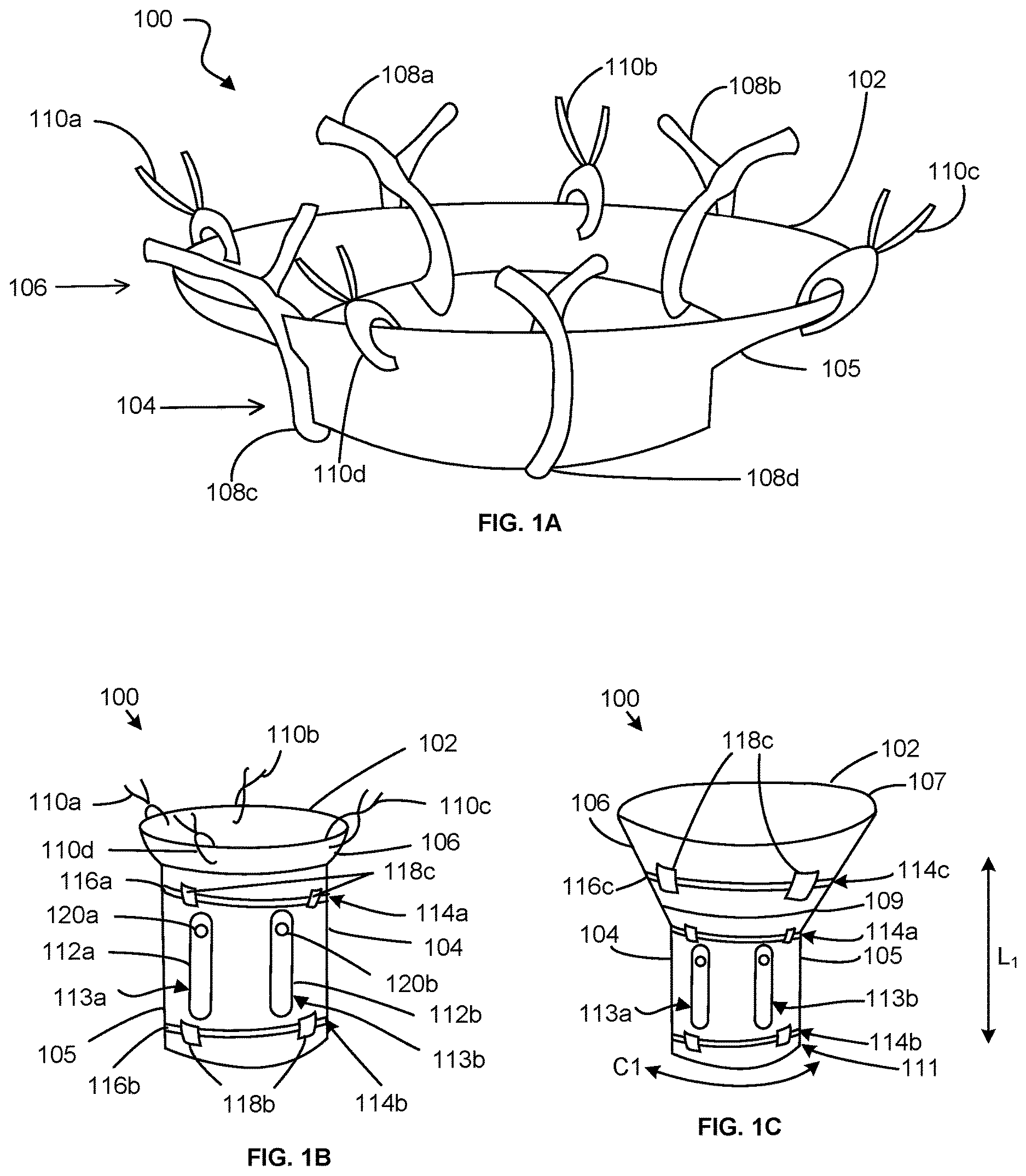 Patent US12616563 Figure 1 – Device for mitigating urinary incontinence post prostatectomy