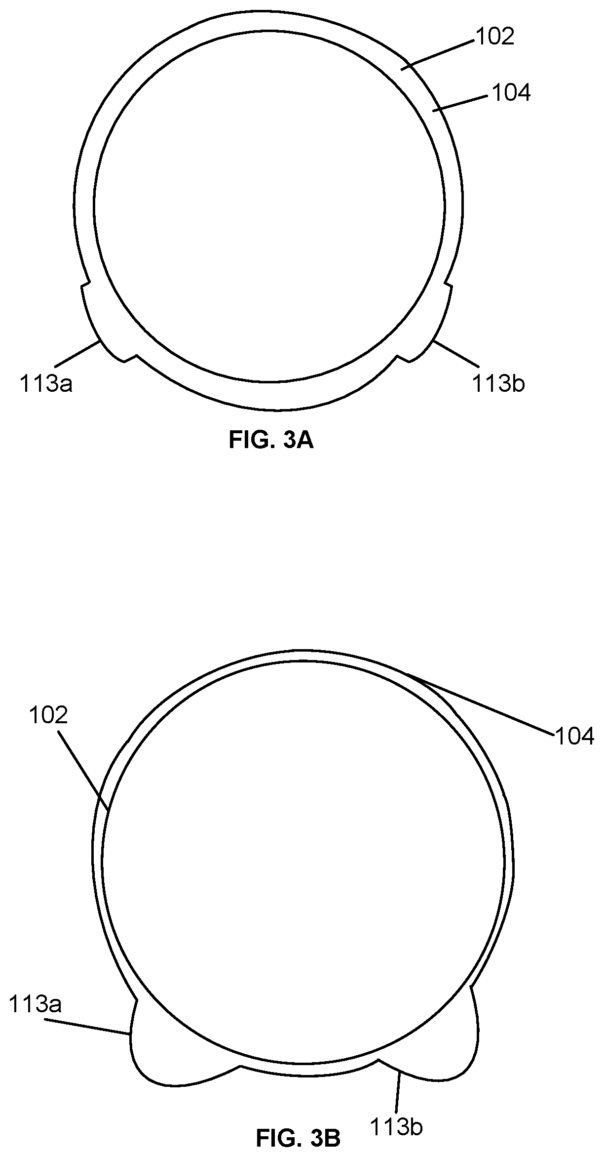 Patent US12616563 Figure 3 – Device for mitigating urinary incontinence post prostatectomy