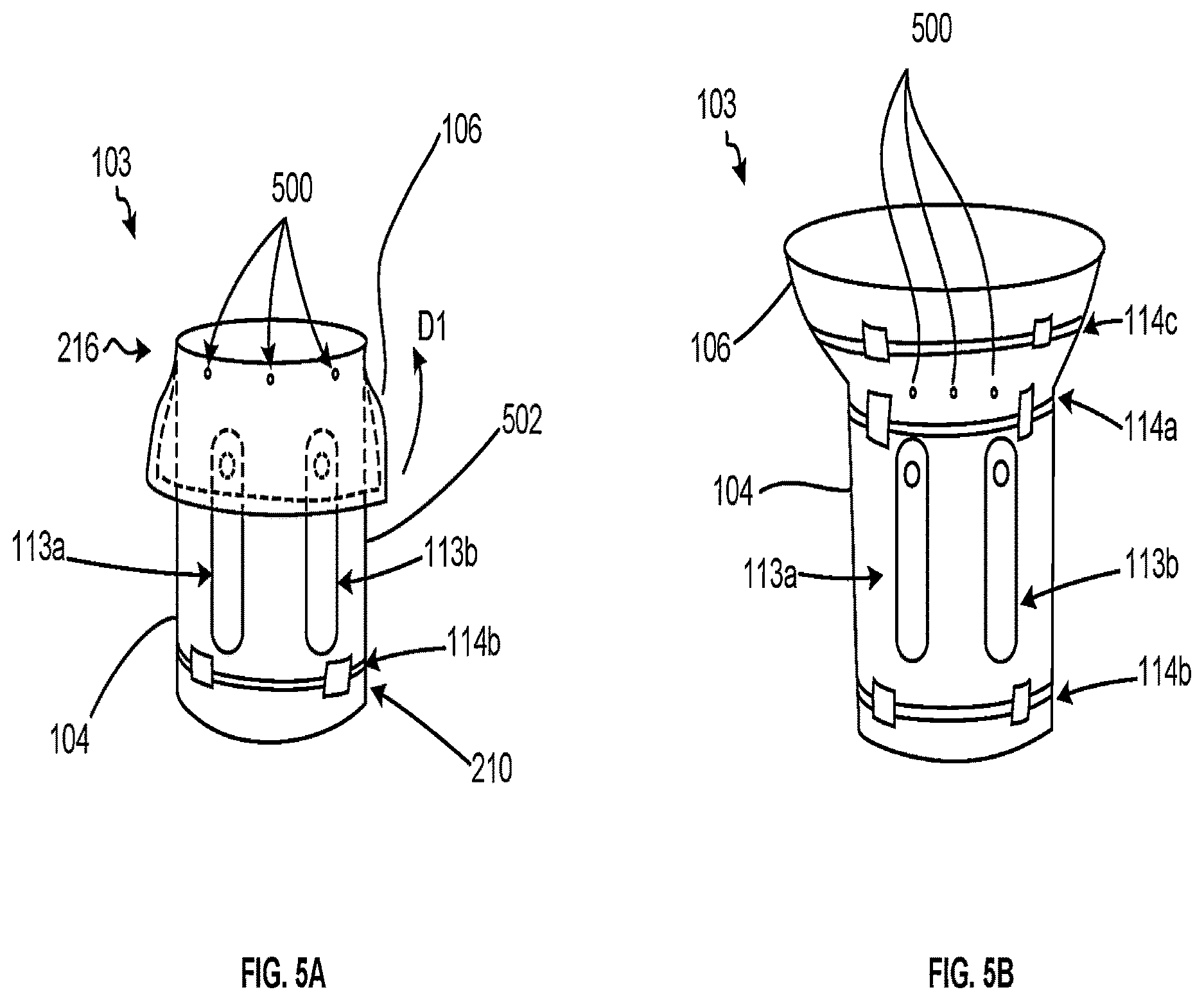Patent US12616563 Figure 5 – Device for mitigating urinary incontinence post prostatectomy