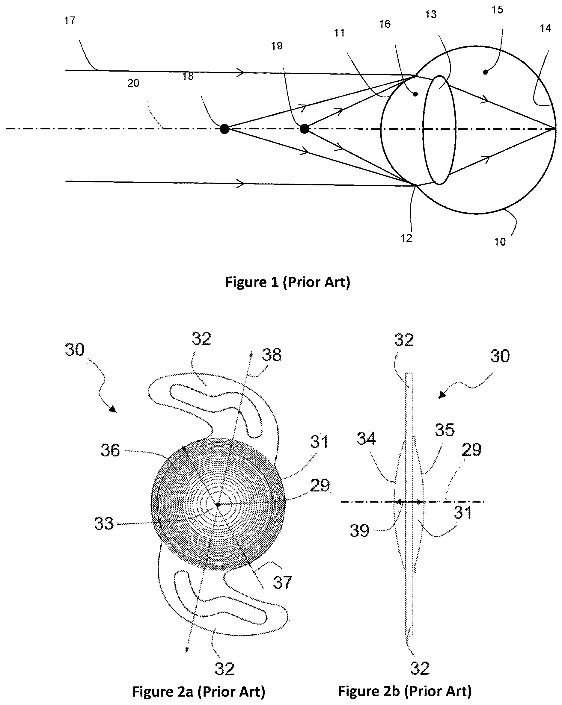 Patent US12616566 — Adaptive multifocal diffractive ocular lens — Figure 1