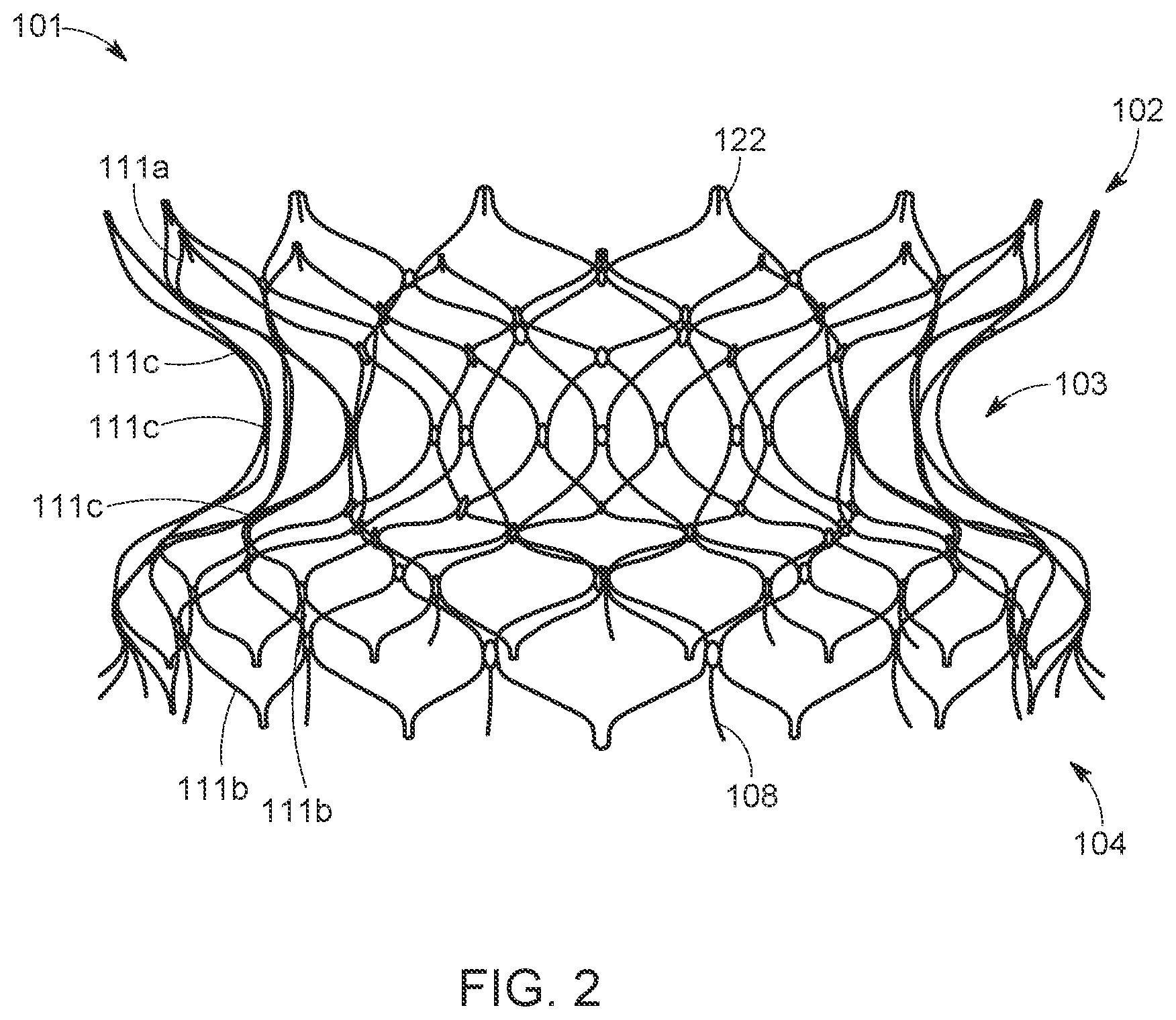 Patent US12616568 Figure 2 – Two stage tricuspid valve implant