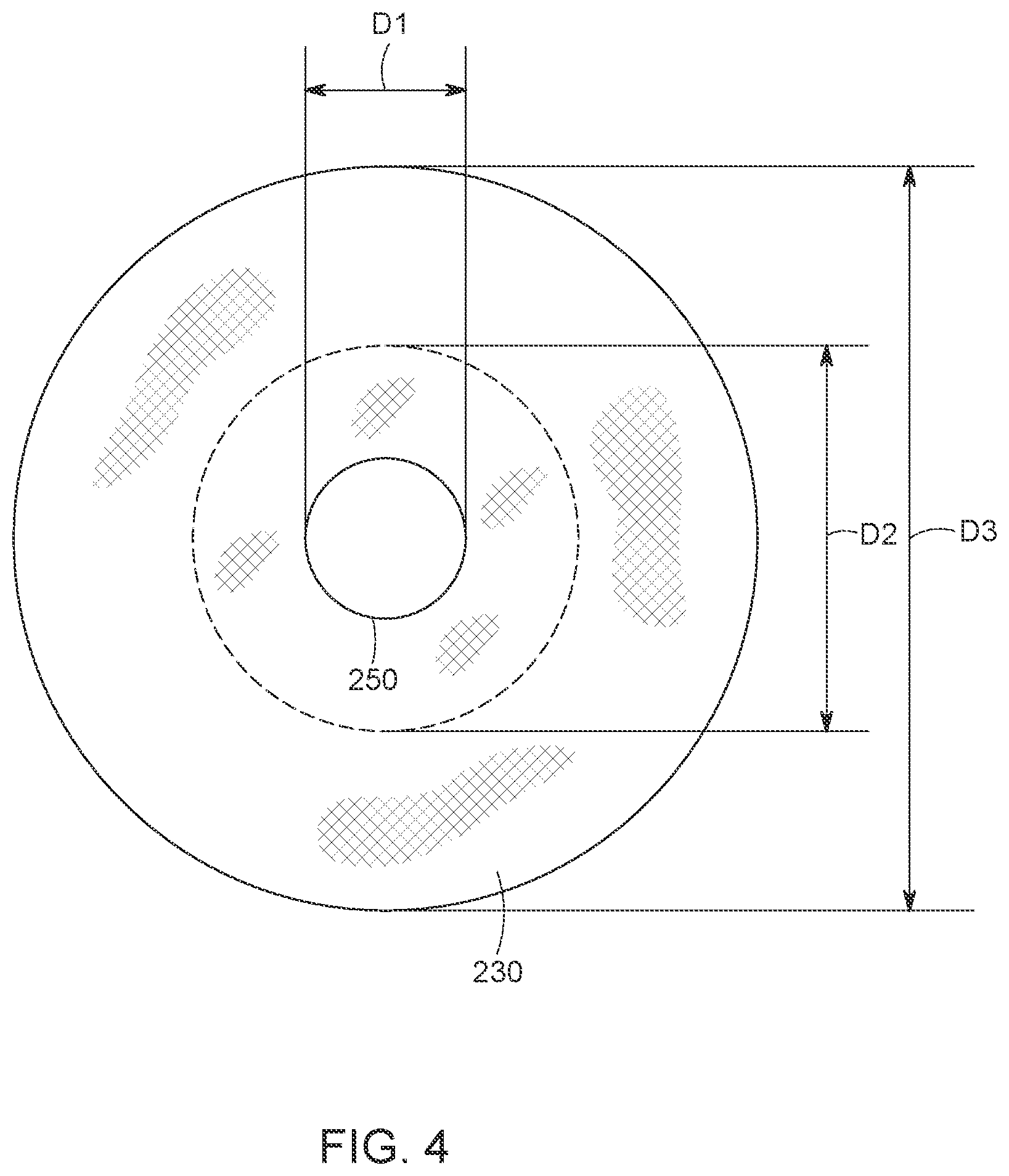 Patent US12616568 Figure 4 – Two stage tricuspid valve implant