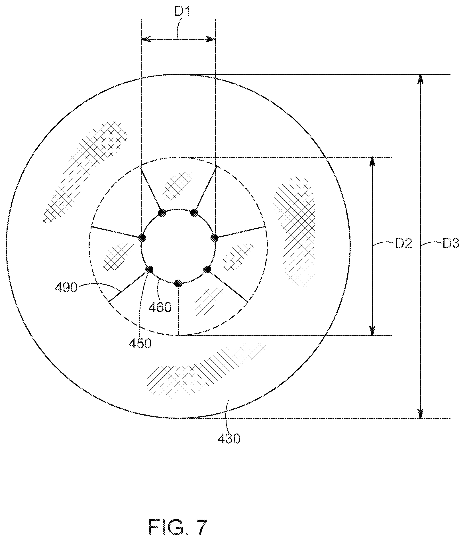 Patent US12616568 Figure 7 – Two stage tricuspid valve implant