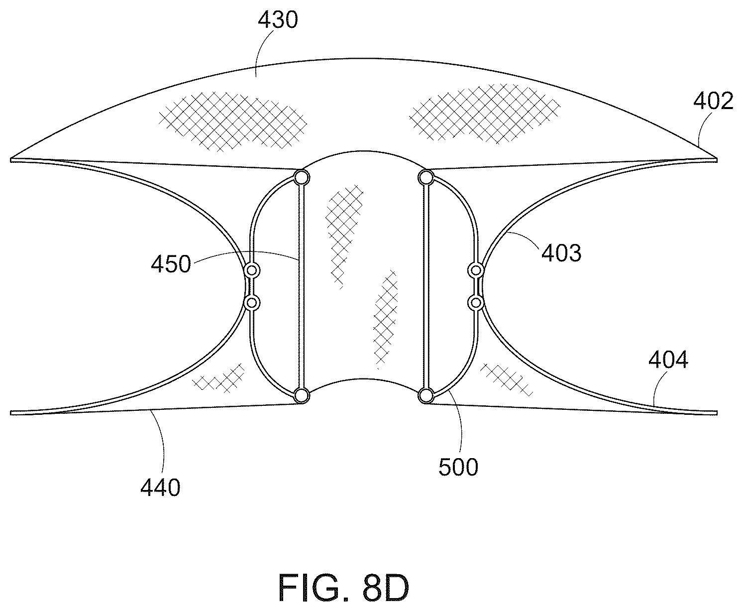 Patent US12616568 Figure 9 – Two stage tricuspid valve implant