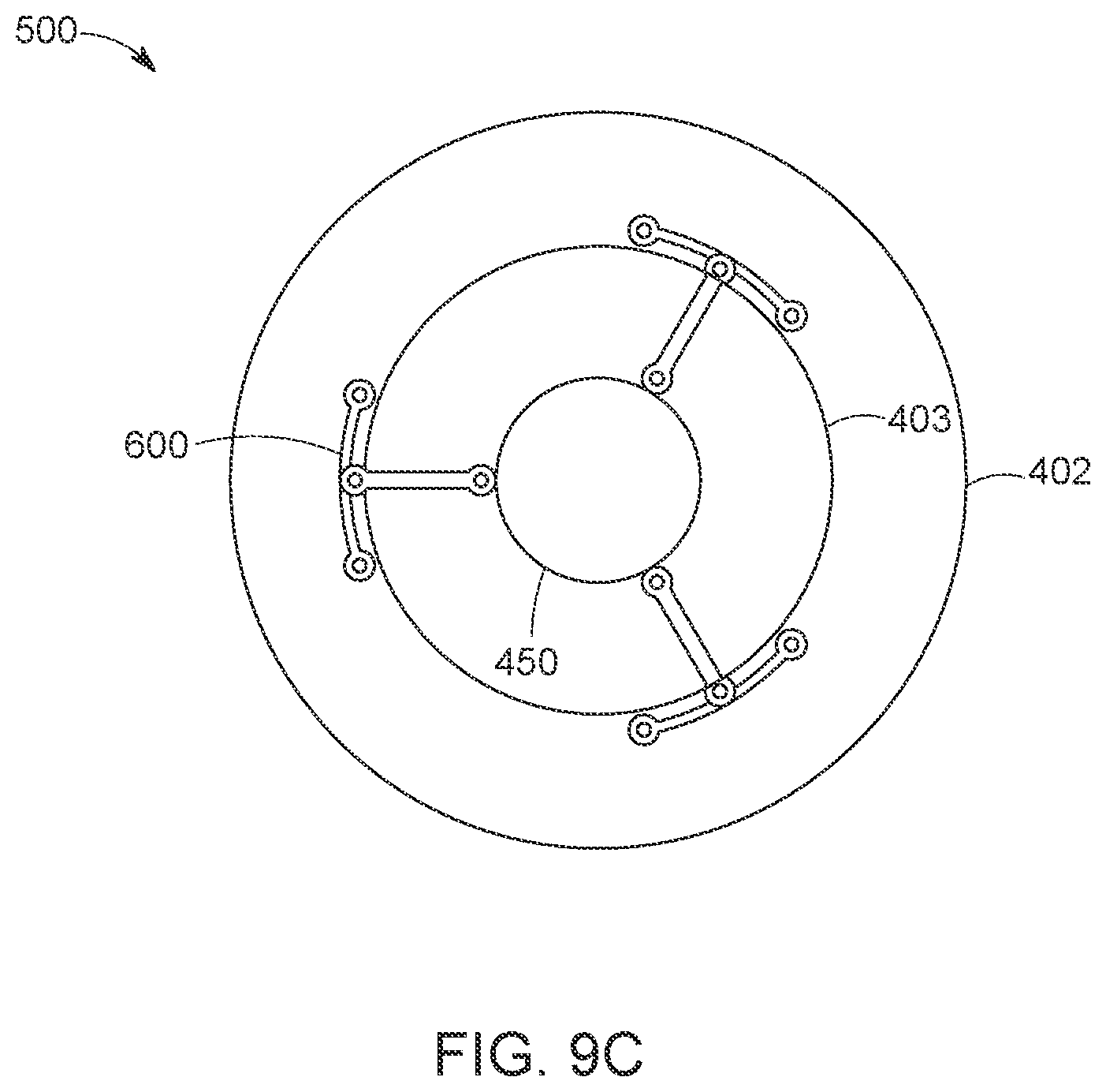Patent US12616568 Figure 11 – Two stage tricuspid valve implant