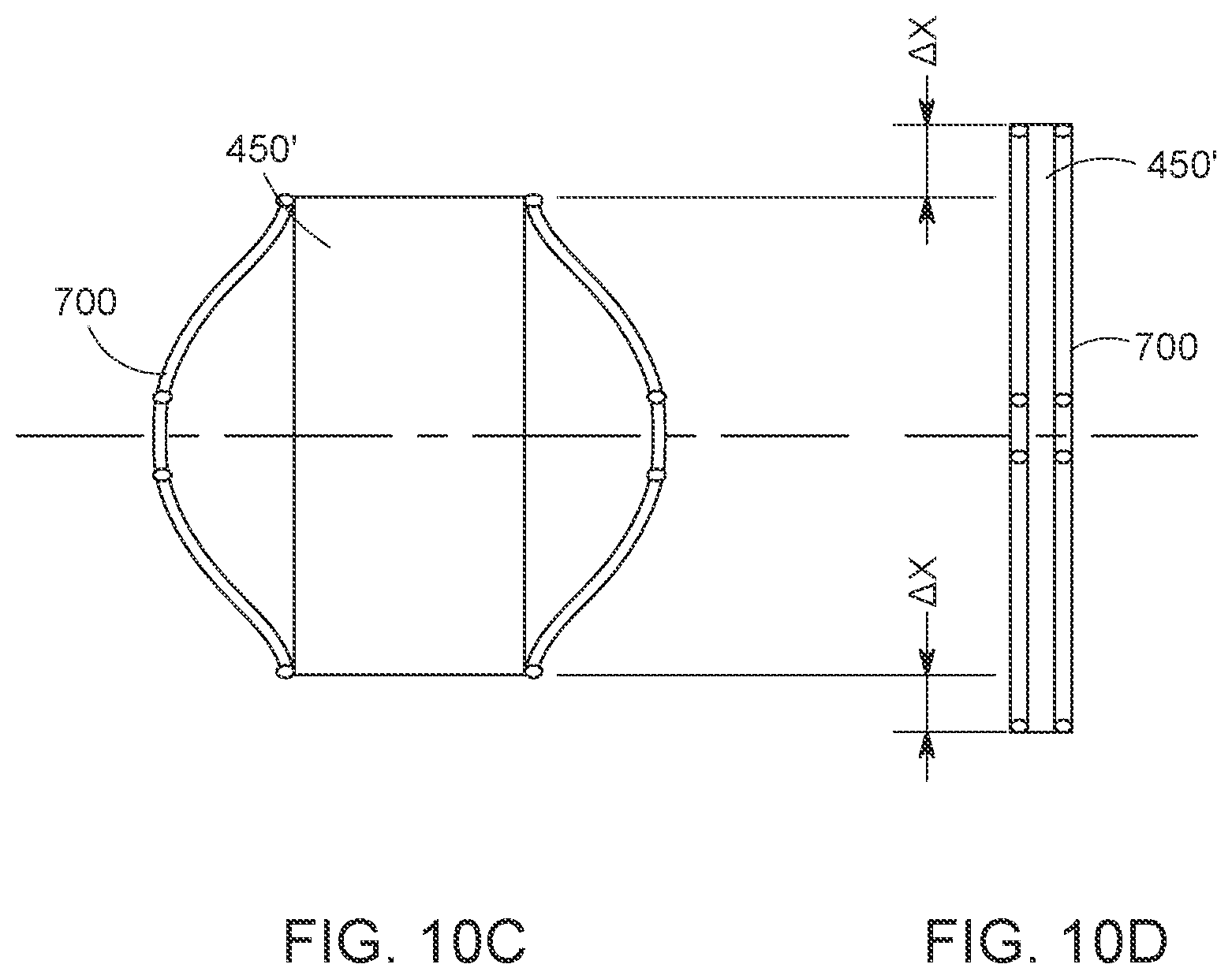 Patent US12616568 Figure 13 – Two stage tricuspid valve implant