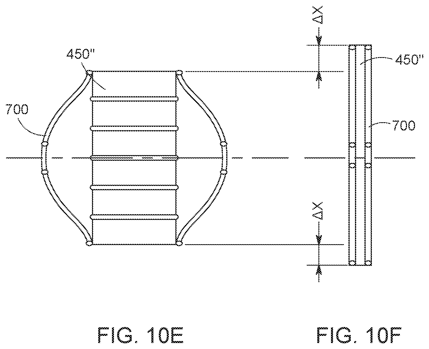 Patent US12616568 Figure 14 – Two stage tricuspid valve implant