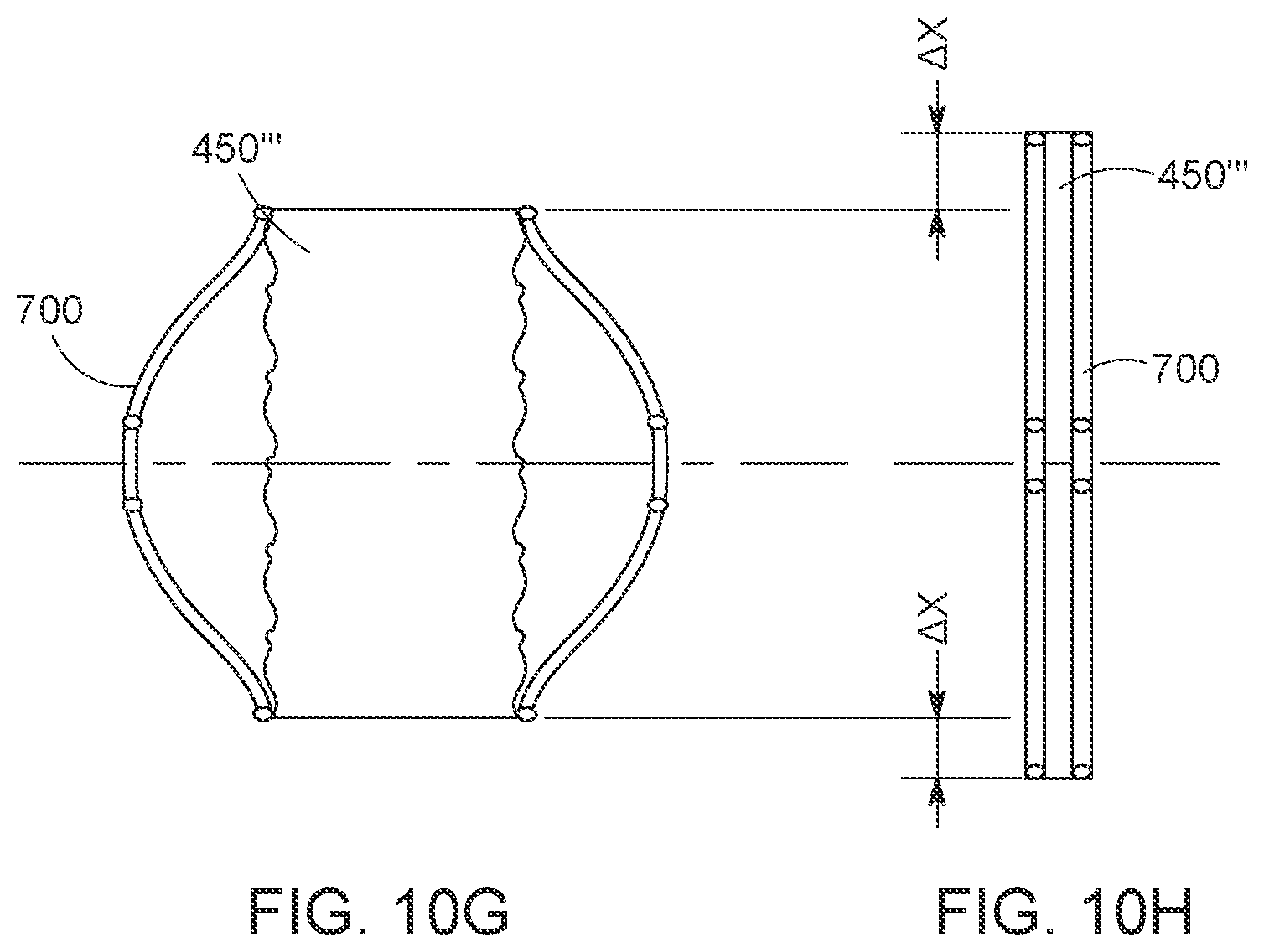 Patent US12616568 Figure 15 – Two stage tricuspid valve implant