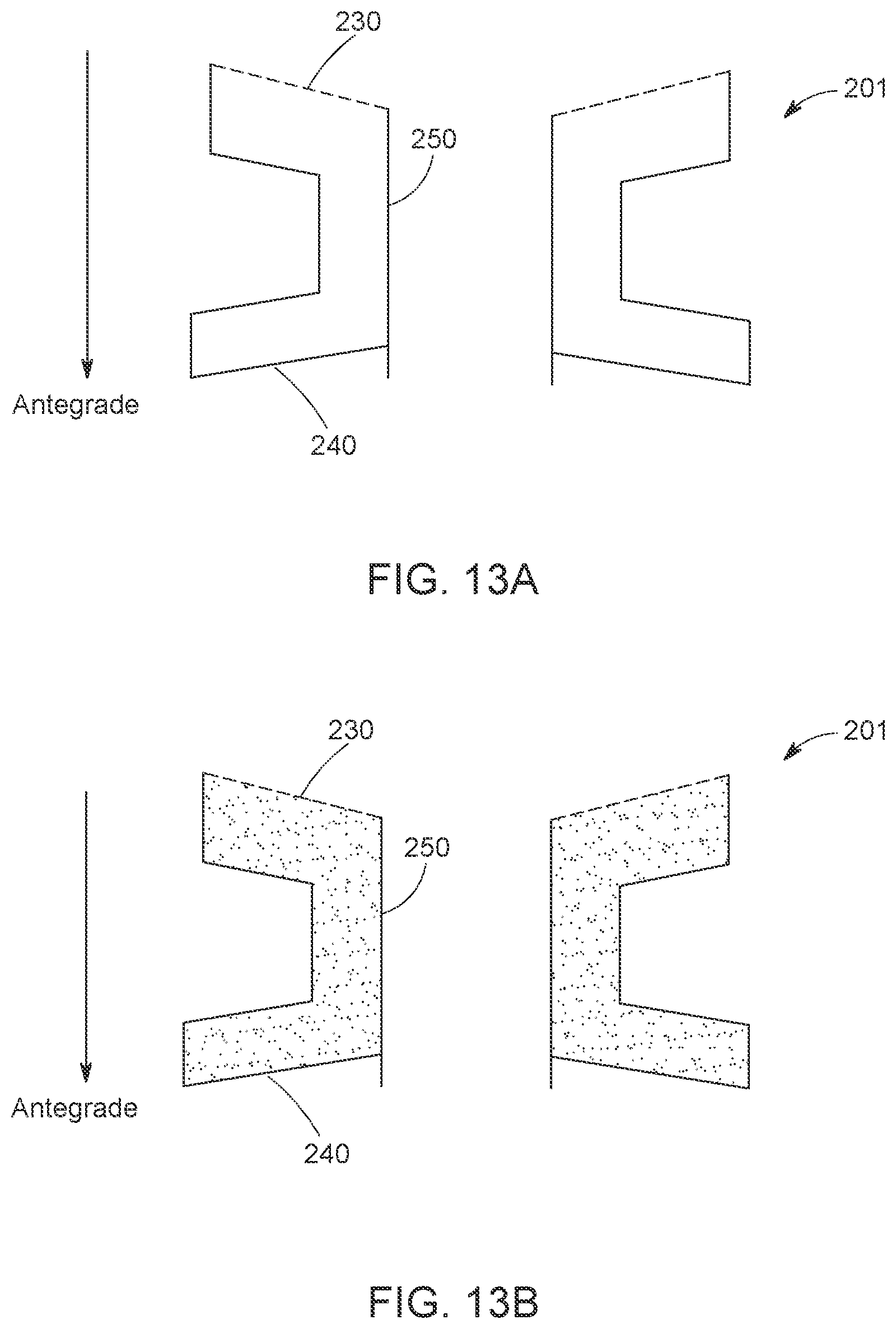 Patent US12616568 Figure 18 – Two stage tricuspid valve implant