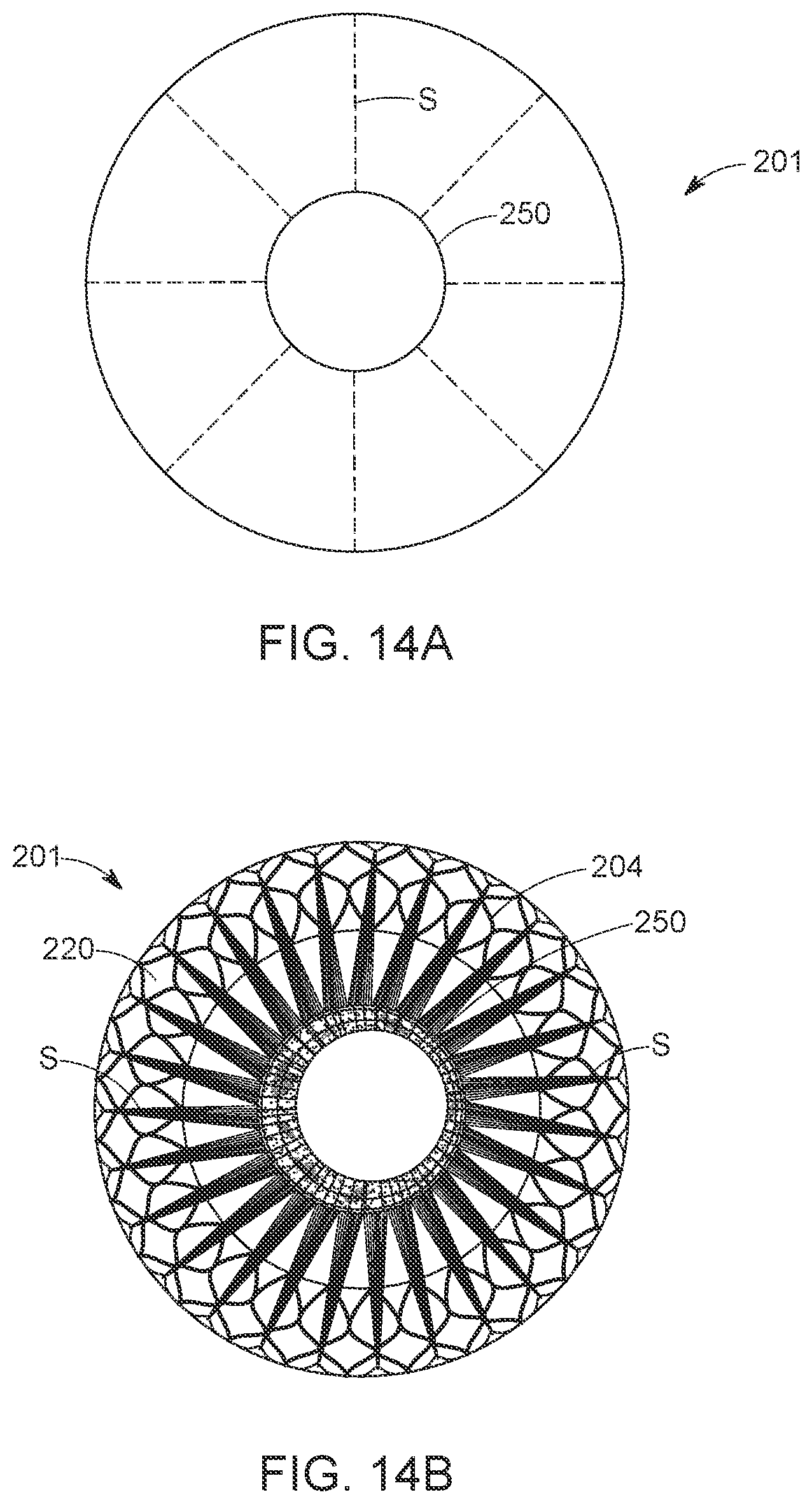 Patent US12616568 Figure 19 – Two stage tricuspid valve implant