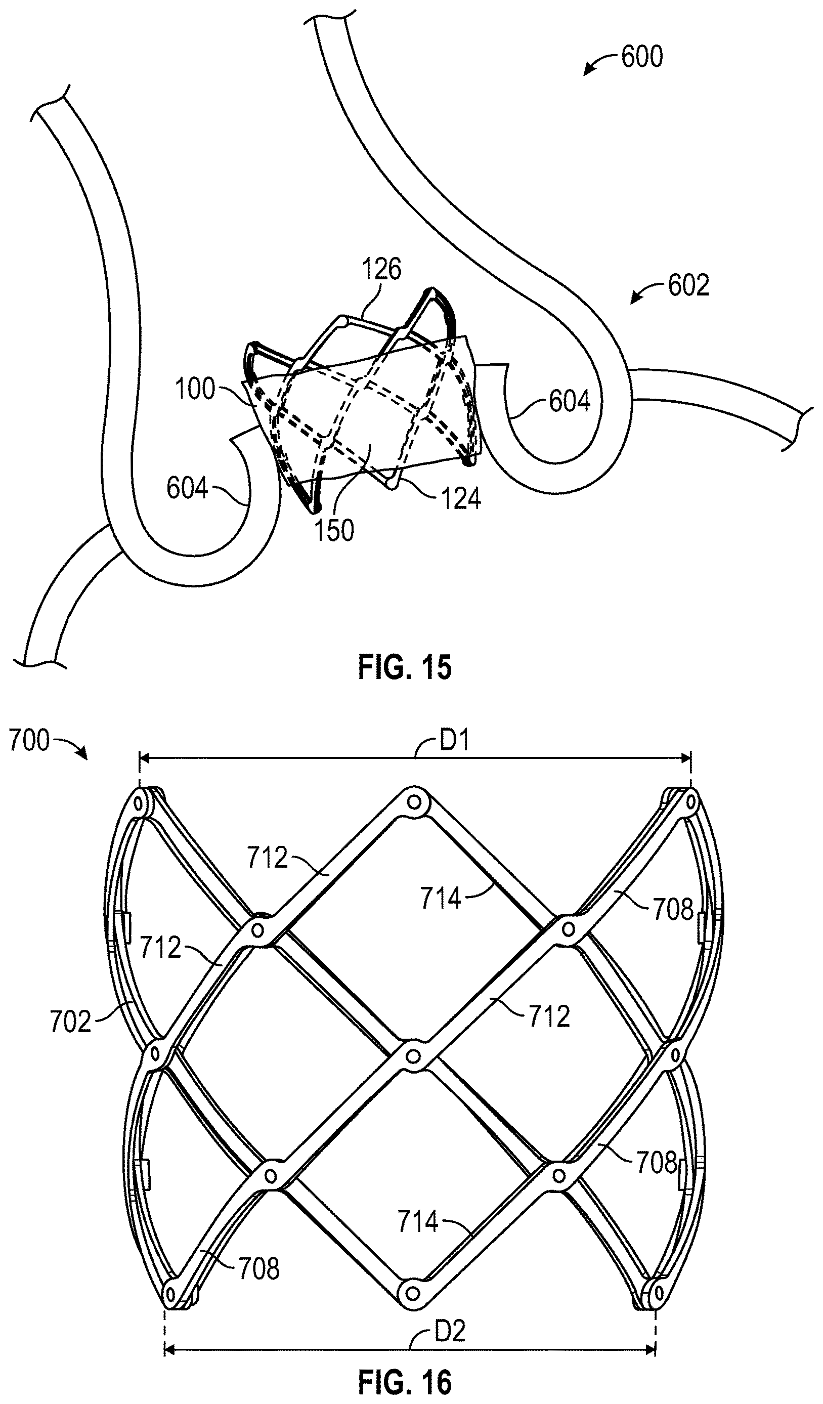Patent US12616569 Figure 12 – Prosthetic heart valve having non-cylindrical frame