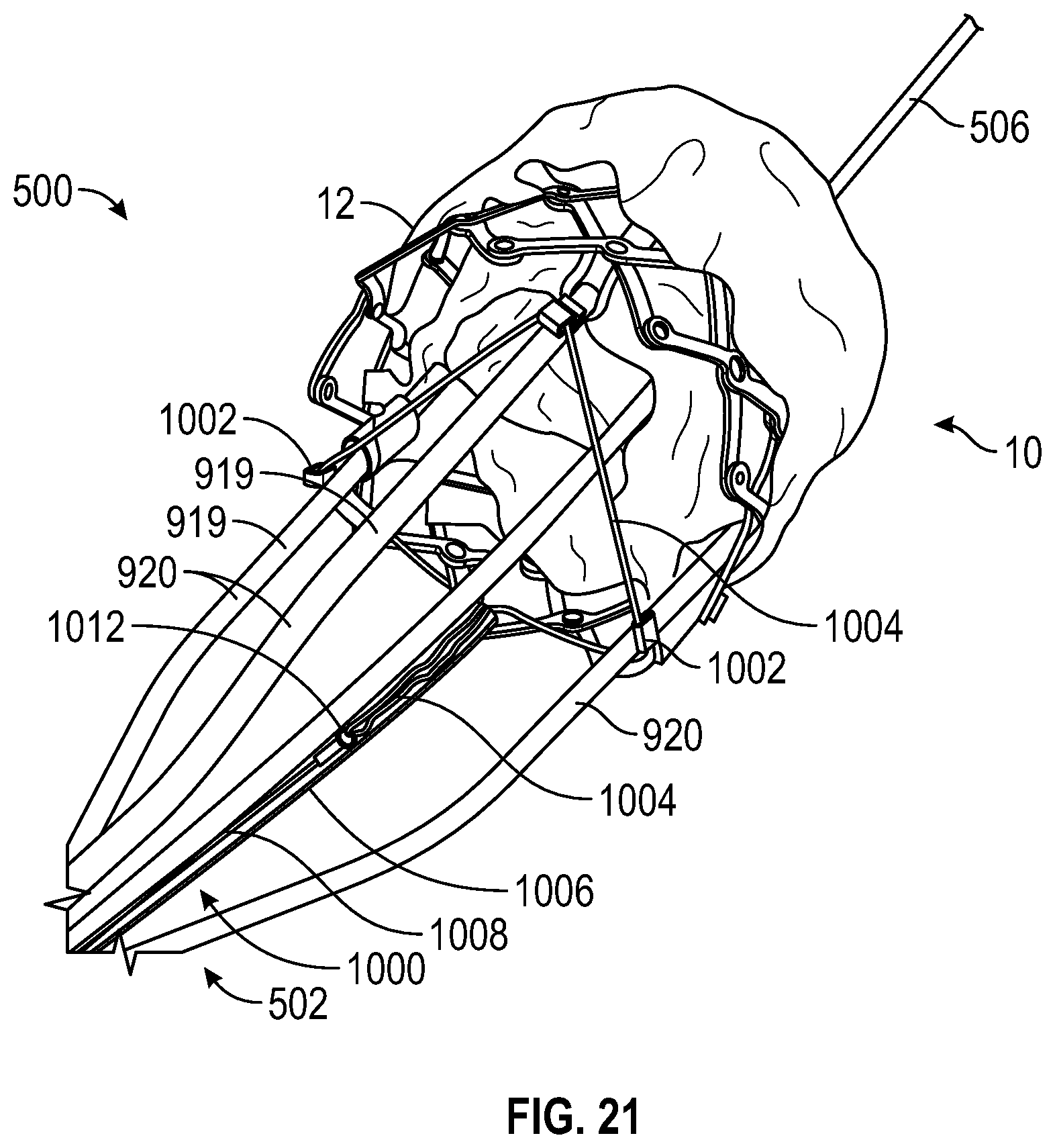 Patent US12616569 Figure 18 – Prosthetic heart valve having non-cylindrical frame