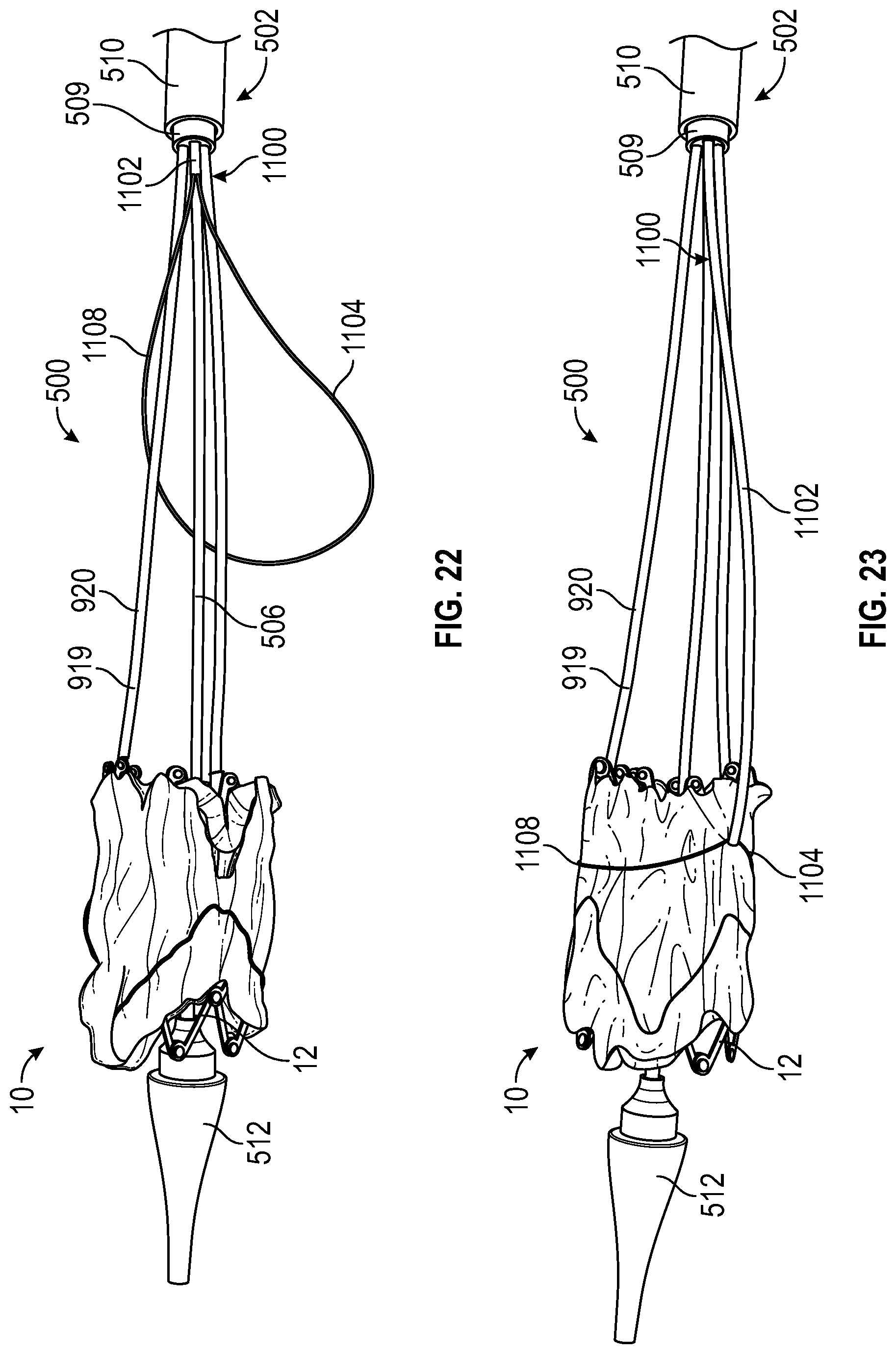 Patent US12616569 Figure 19 – Prosthetic heart valve having non-cylindrical frame
