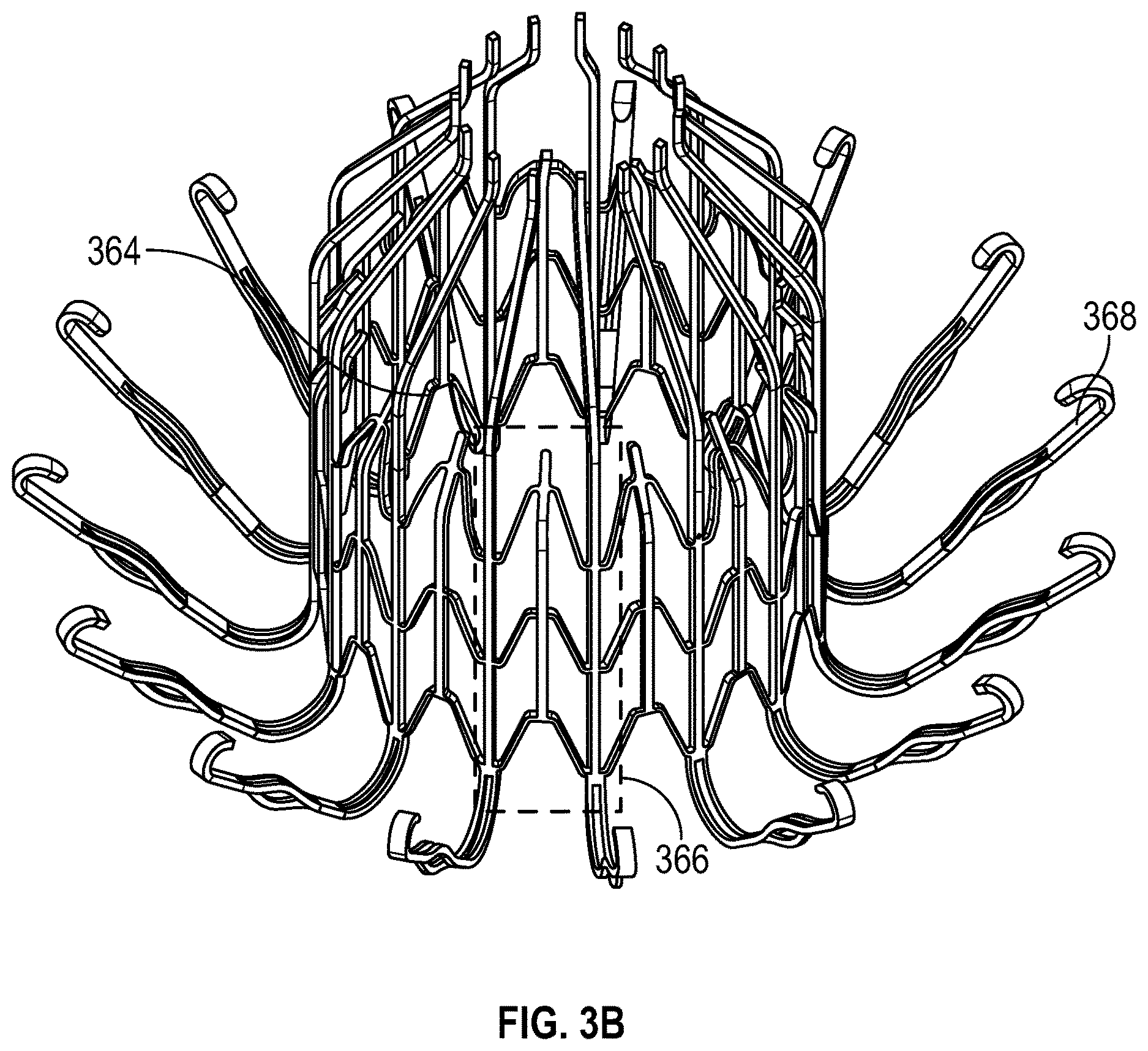 Patent US12616570 Figure 10 – Three-dimensional thin-film leaflet valve device
