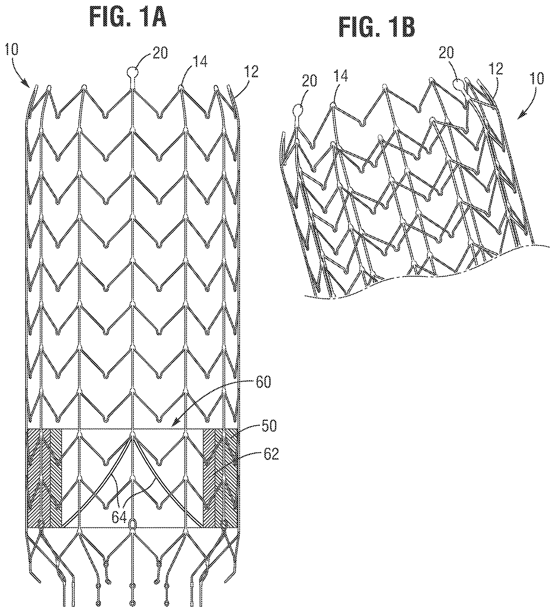 Patent US12616571 Figure 1 – Implantable frame and frame retaining mechanism