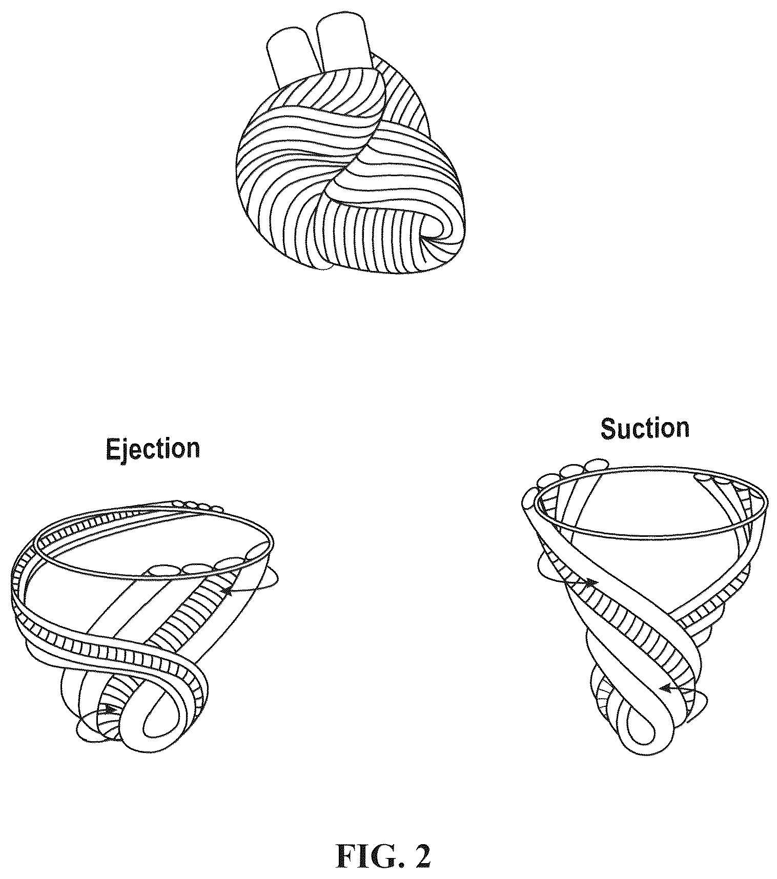 Patent US12616572 Figure 2 – Devices, systems, and methods for a valve replacement