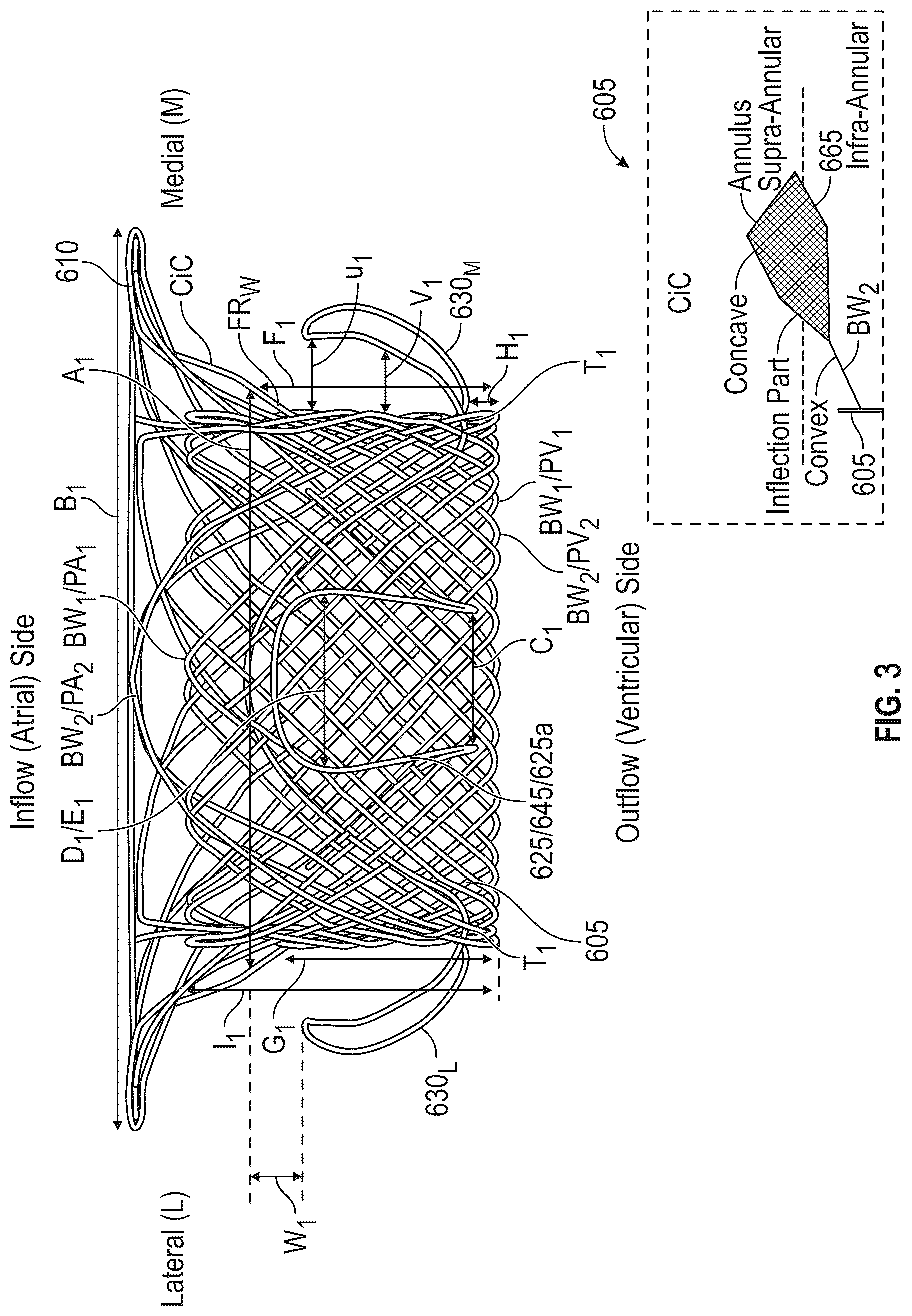 Patent US12616572 Figure 3 – Devices, systems, and methods for a valve replacement