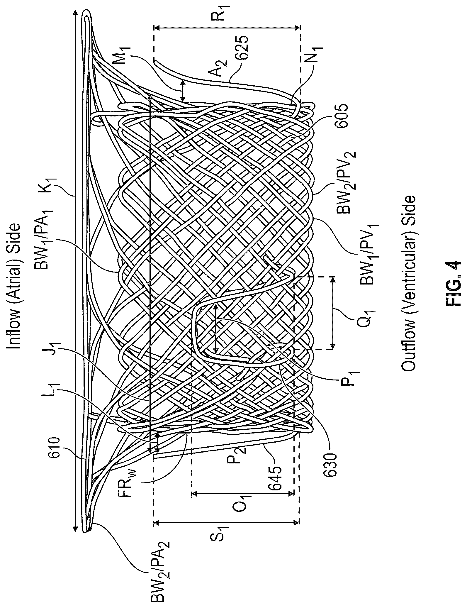 Patent US12616572 Figure 4 – Devices, systems, and methods for a valve replacement