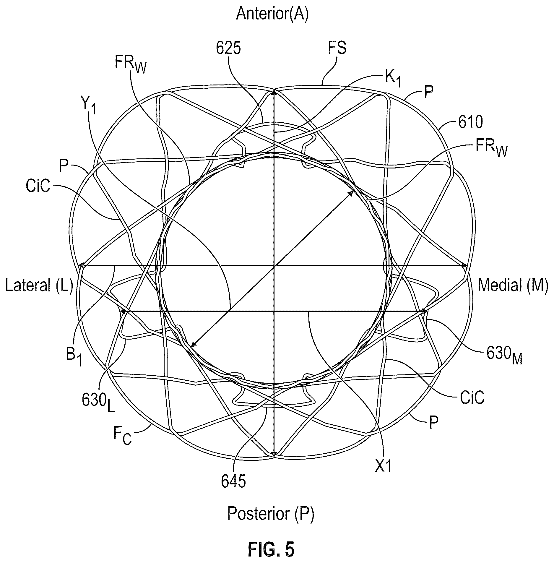 Patent US12616572 Figure 5 – Devices, systems, and methods for a valve replacement