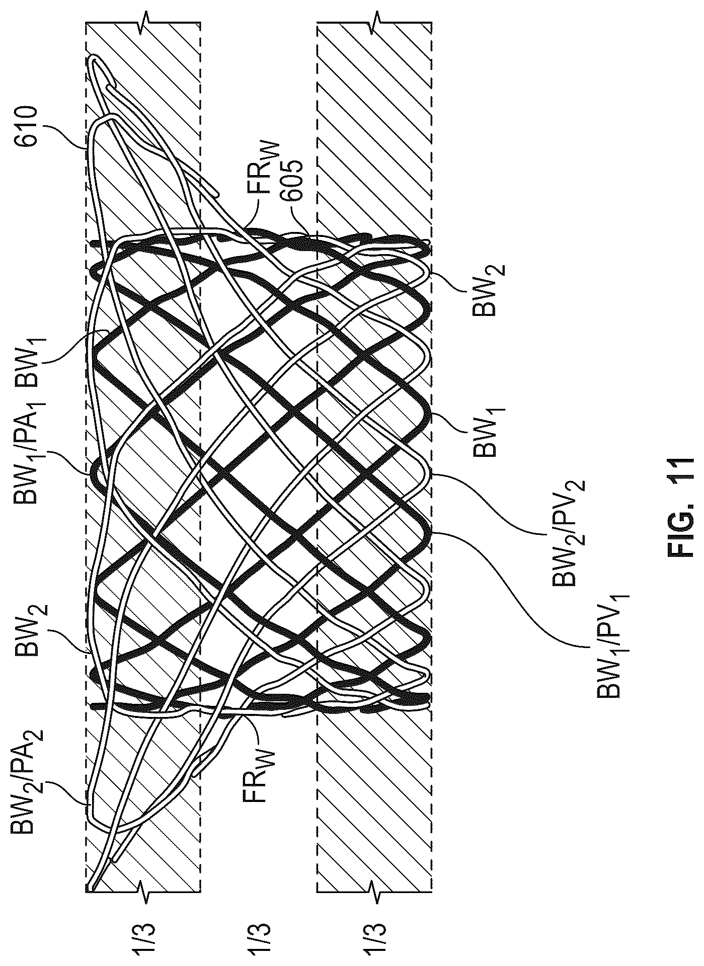 Patent US12616572 Figure 8 – Devices, systems, and methods for a valve replacement