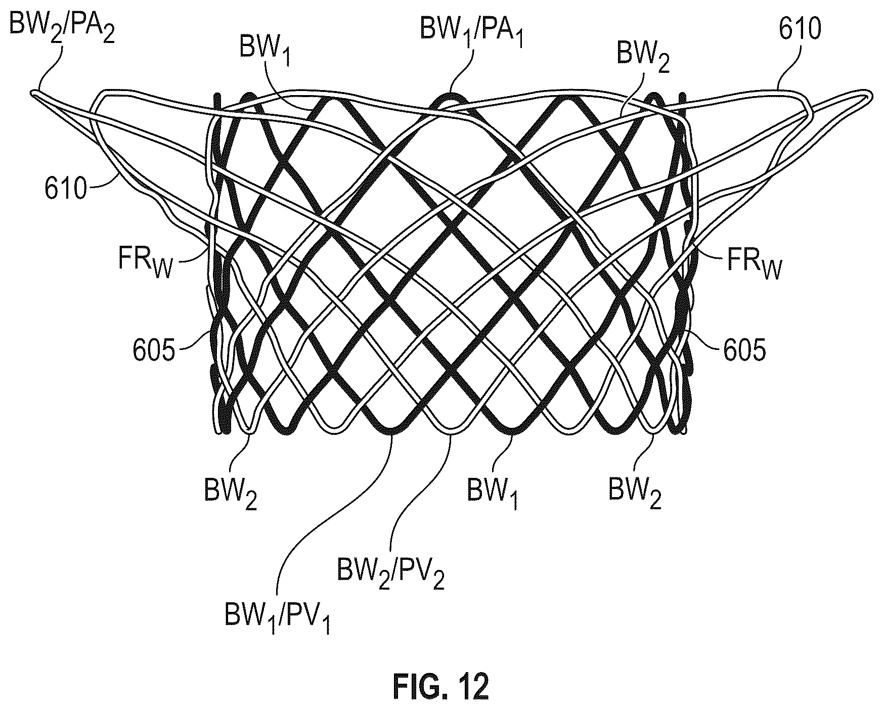Patent US12616572 Figure 9 – Devices, systems, and methods for a valve replacement