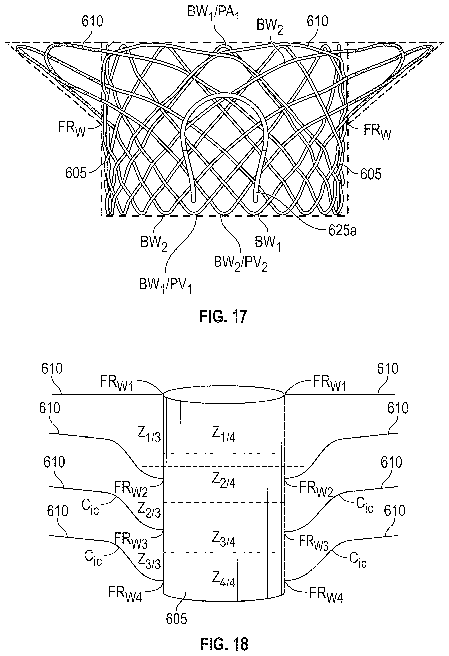 Patent US12616572 Figure 12 – Devices, systems, and methods for a valve replacement