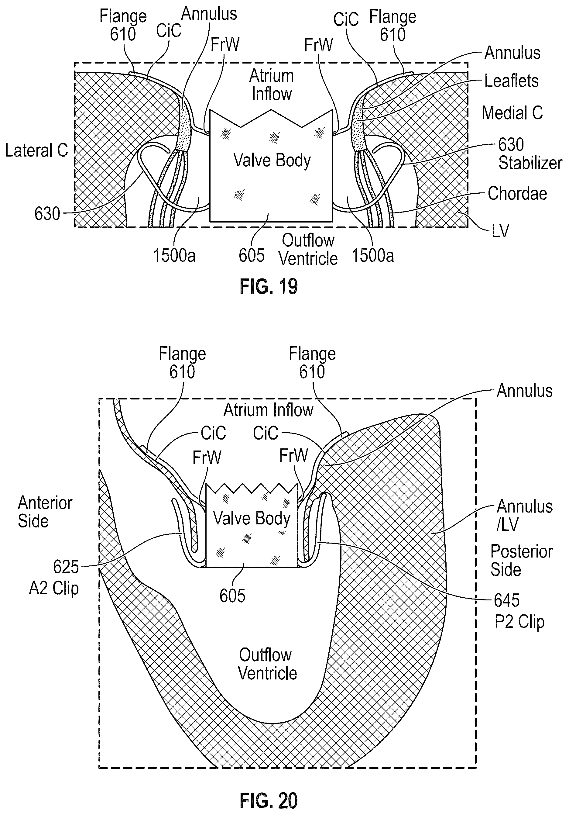 Patent US12616572 Figure 13 – Devices, systems, and methods for a valve replacement