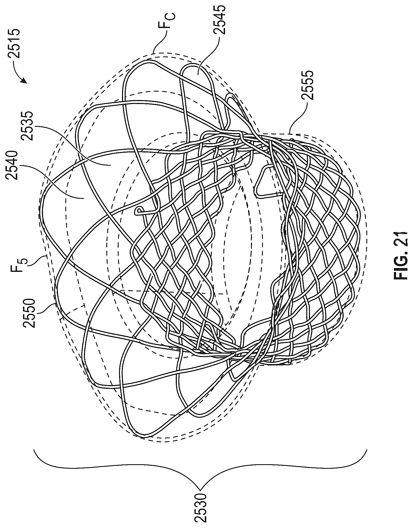 Patent US12616572 Figure 14 – Devices, systems, and methods for a valve replacement