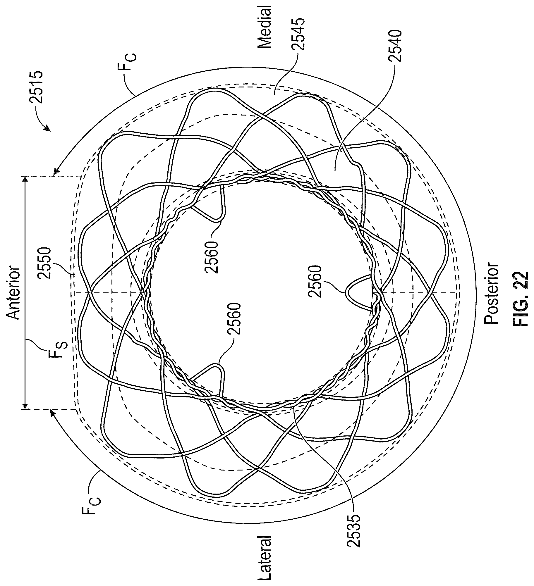 Patent US12616572 Figure 15 – Devices, systems, and methods for a valve replacement