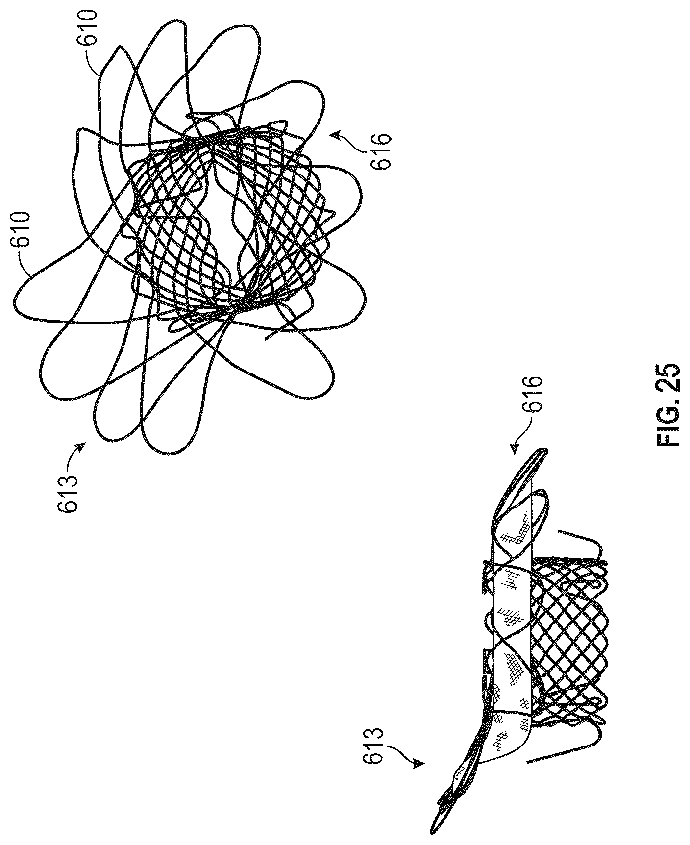 Patent US12616572 Figure 18 – Devices, systems, and methods for a valve replacement