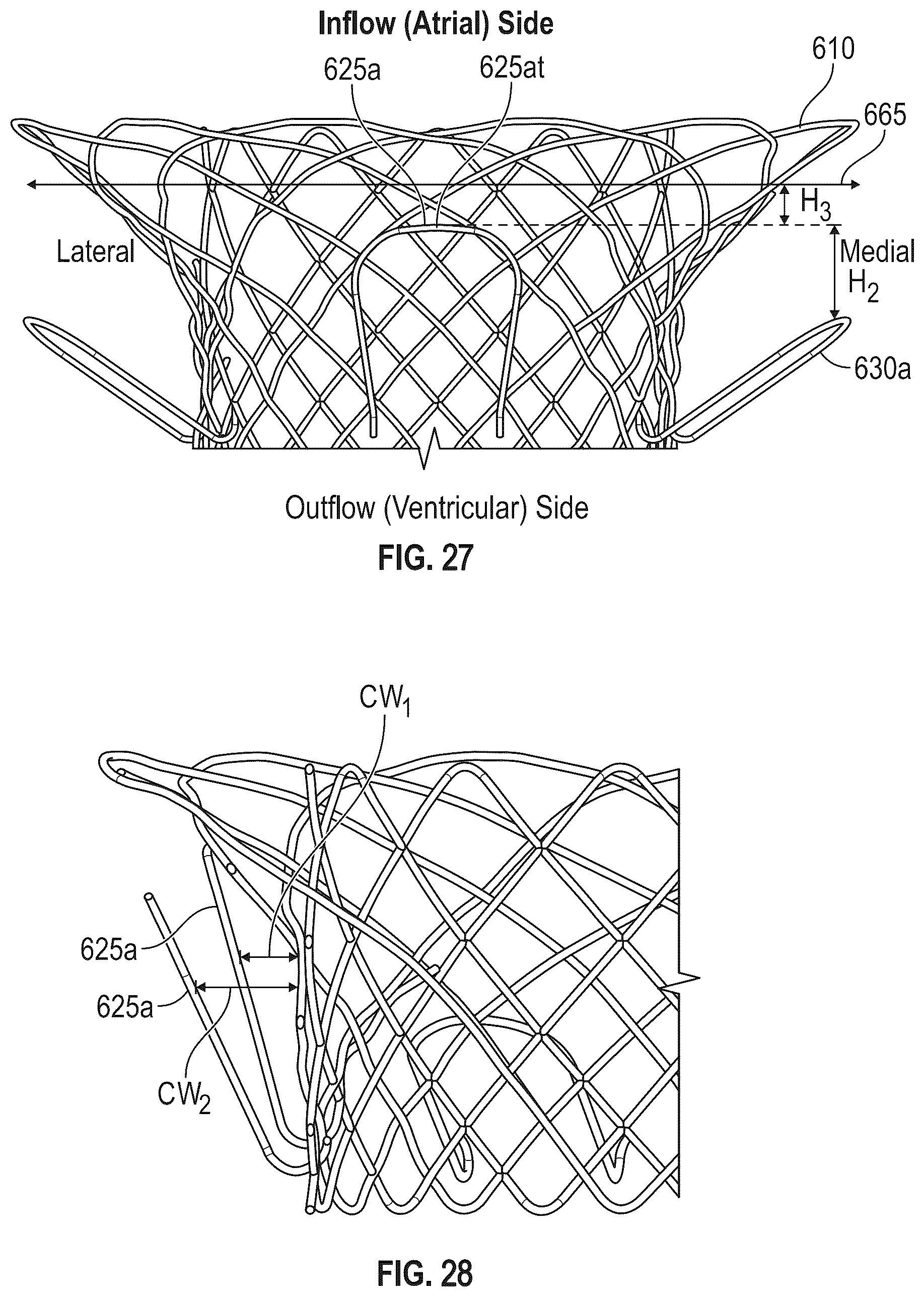 Patent US12616572 Figure 20 – Devices, systems, and methods for a valve replacement