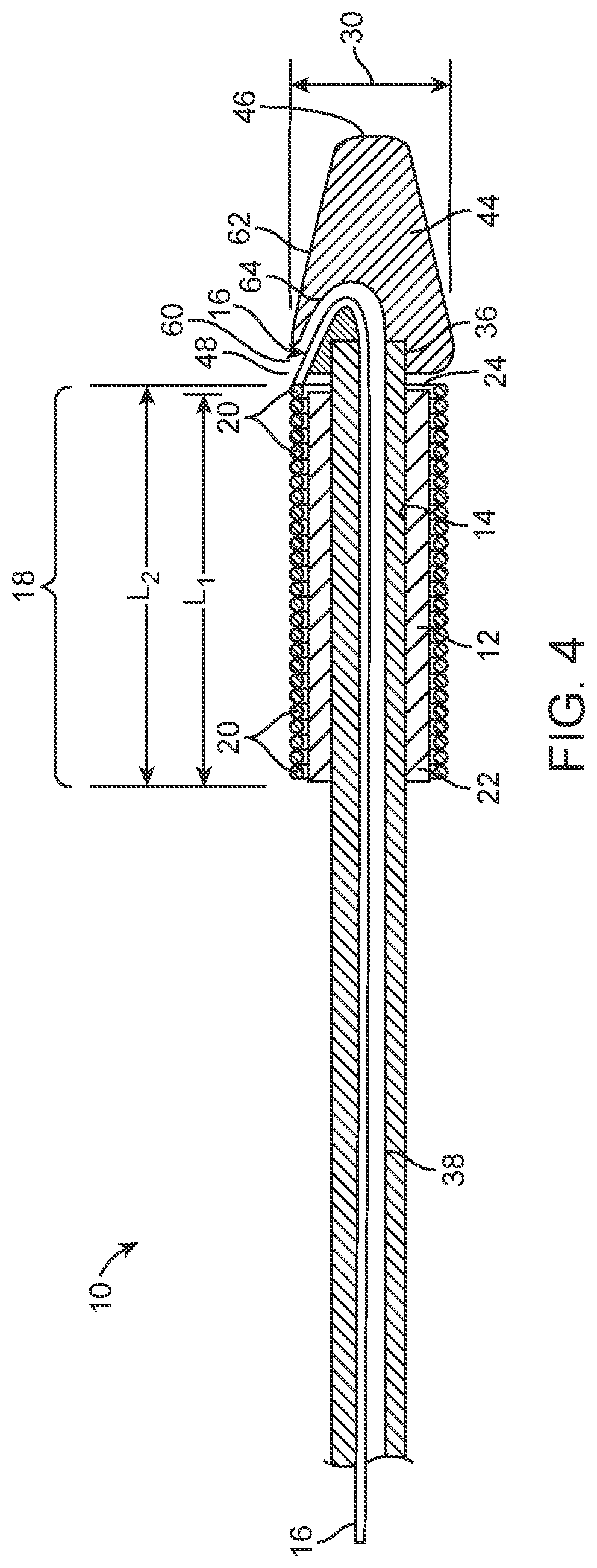 Patent US12616573 Figure 4 – Prosthetic valve delivery system and method
