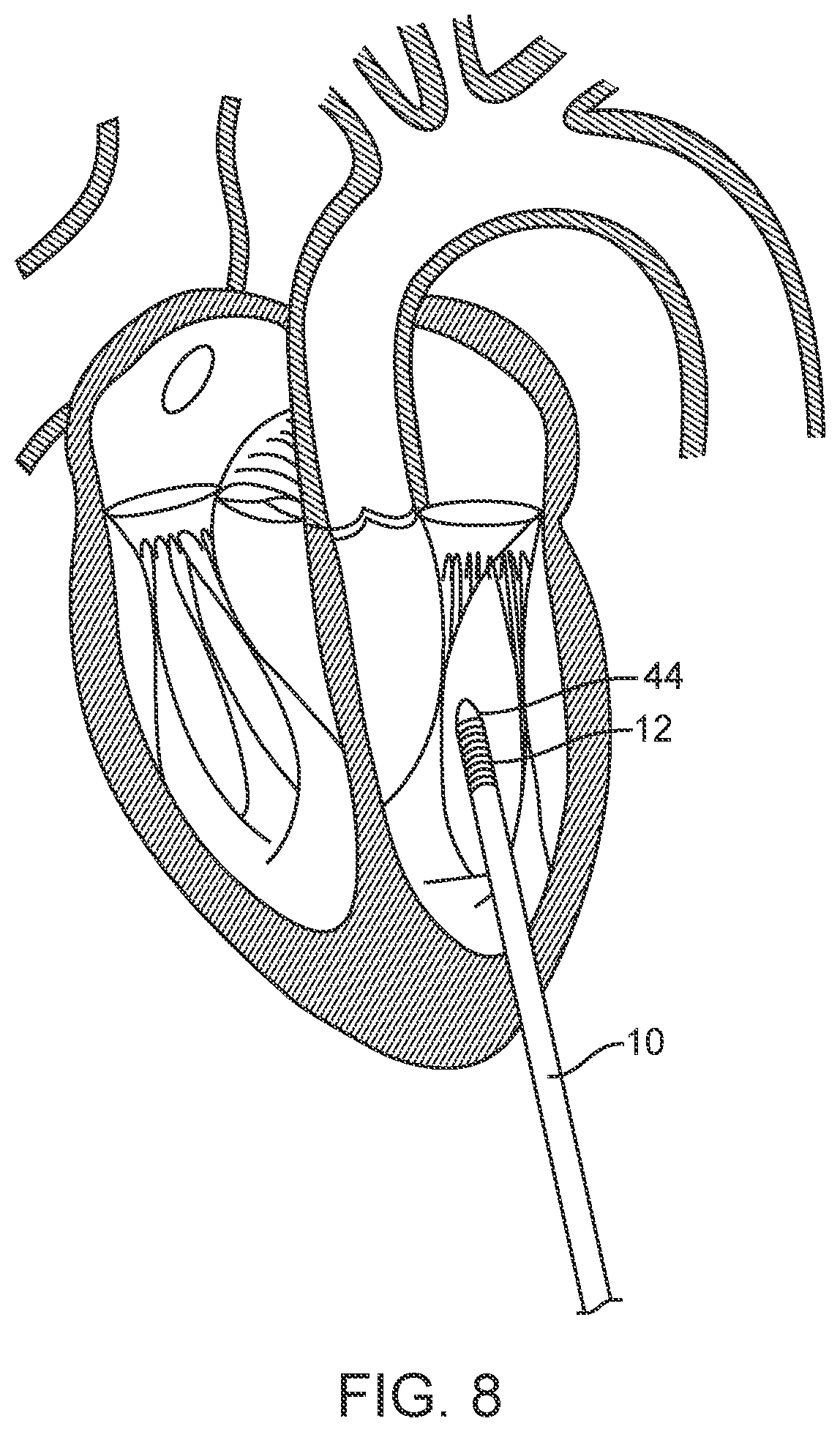 Patent US12616573 Figure 9 – Prosthetic valve delivery system and method