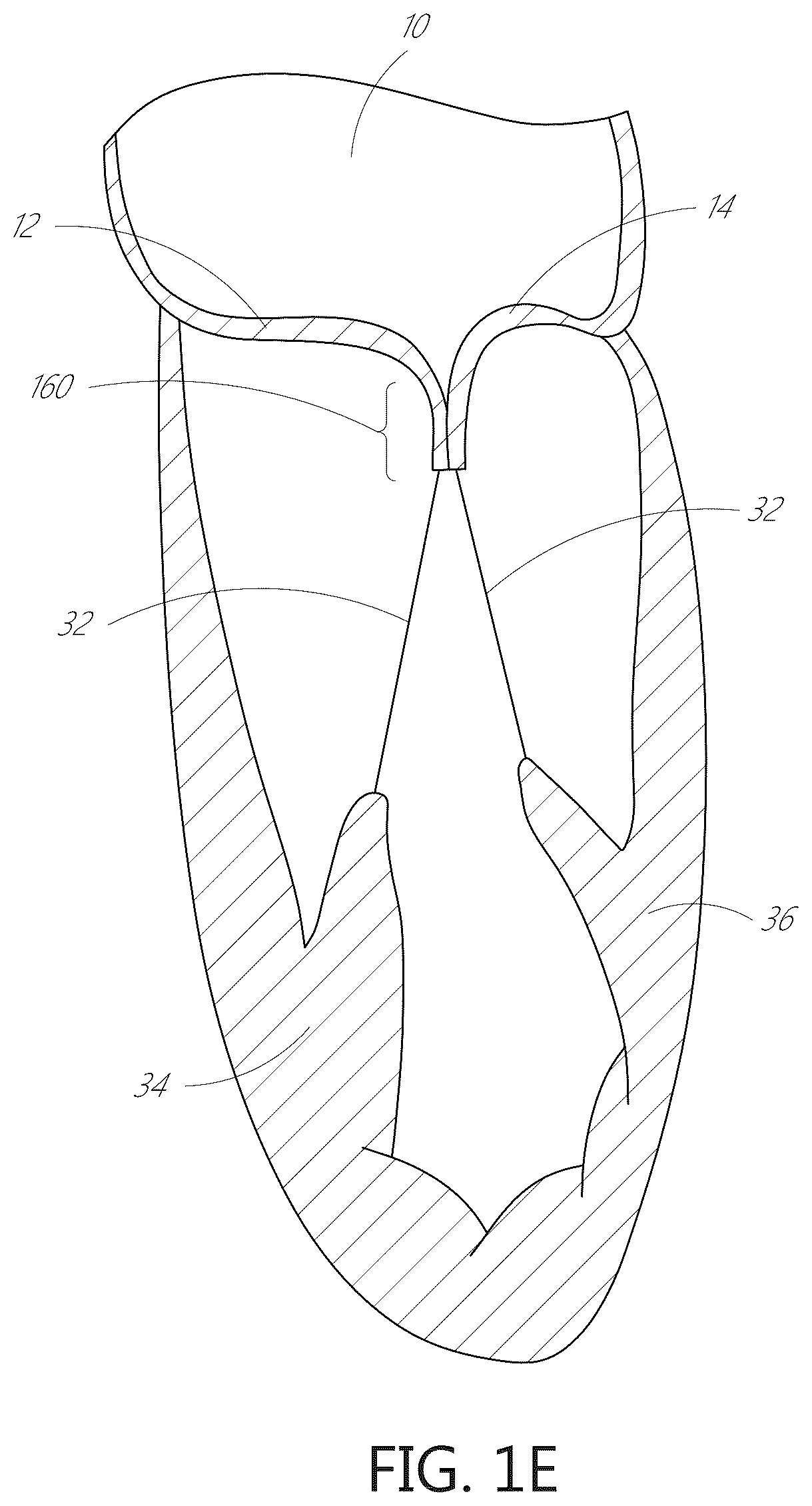 Patent US12616574 Figure 3 – Device, system, and method for transcatheter treatment of valvular regurgitation