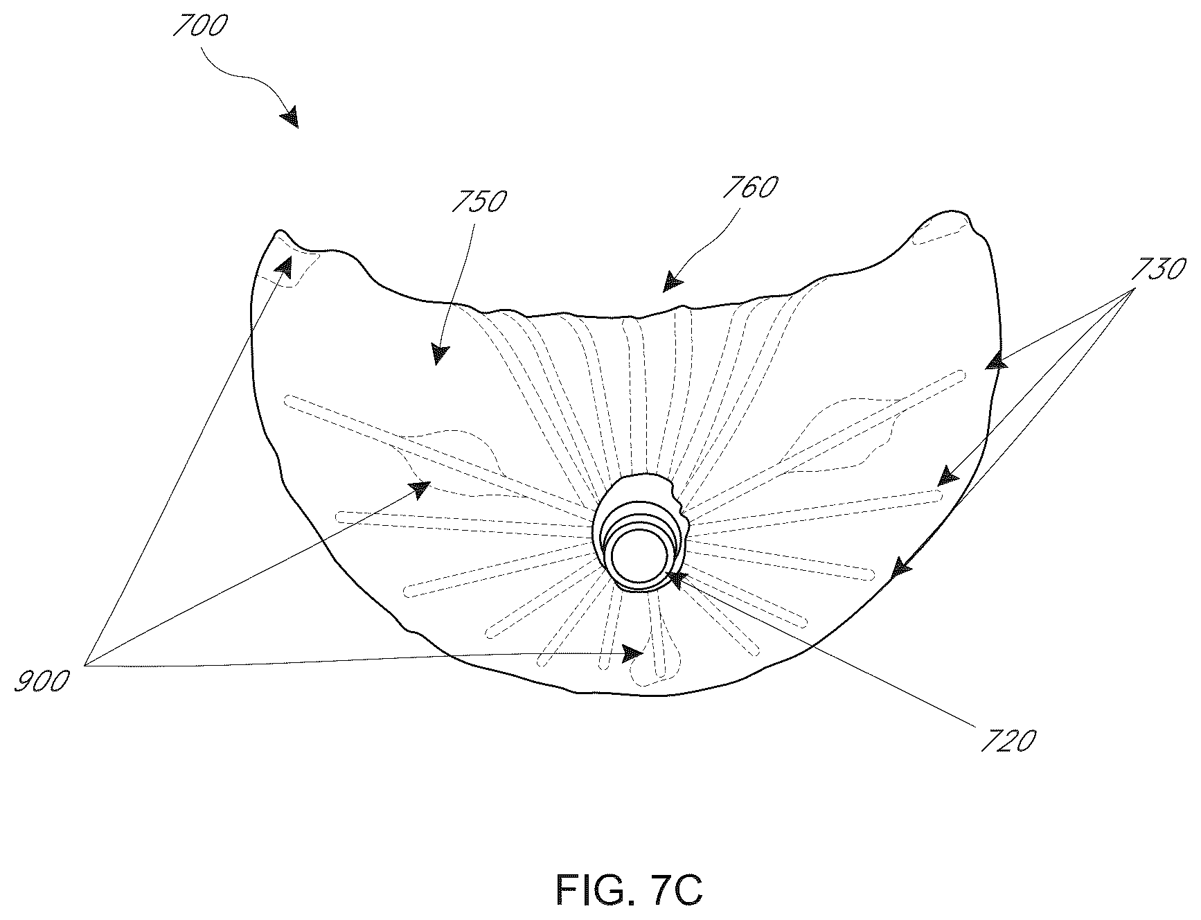 Patent US12616574 Figure 17 – Device, system, and method for transcatheter treatment of valvular regurgitation