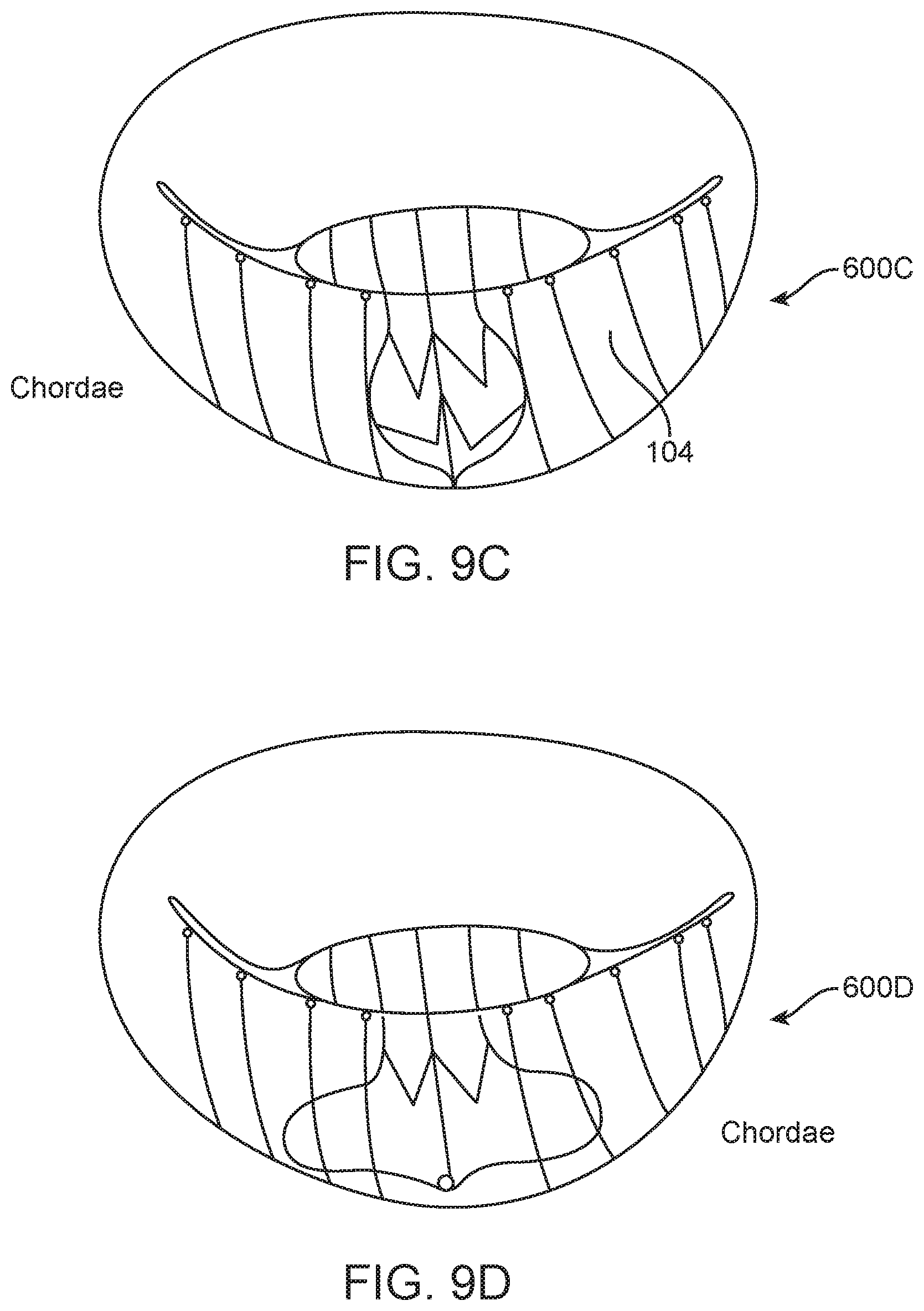 Patent US12616575 Figure 14 – Leaflet extension for cardiac valve leaflet