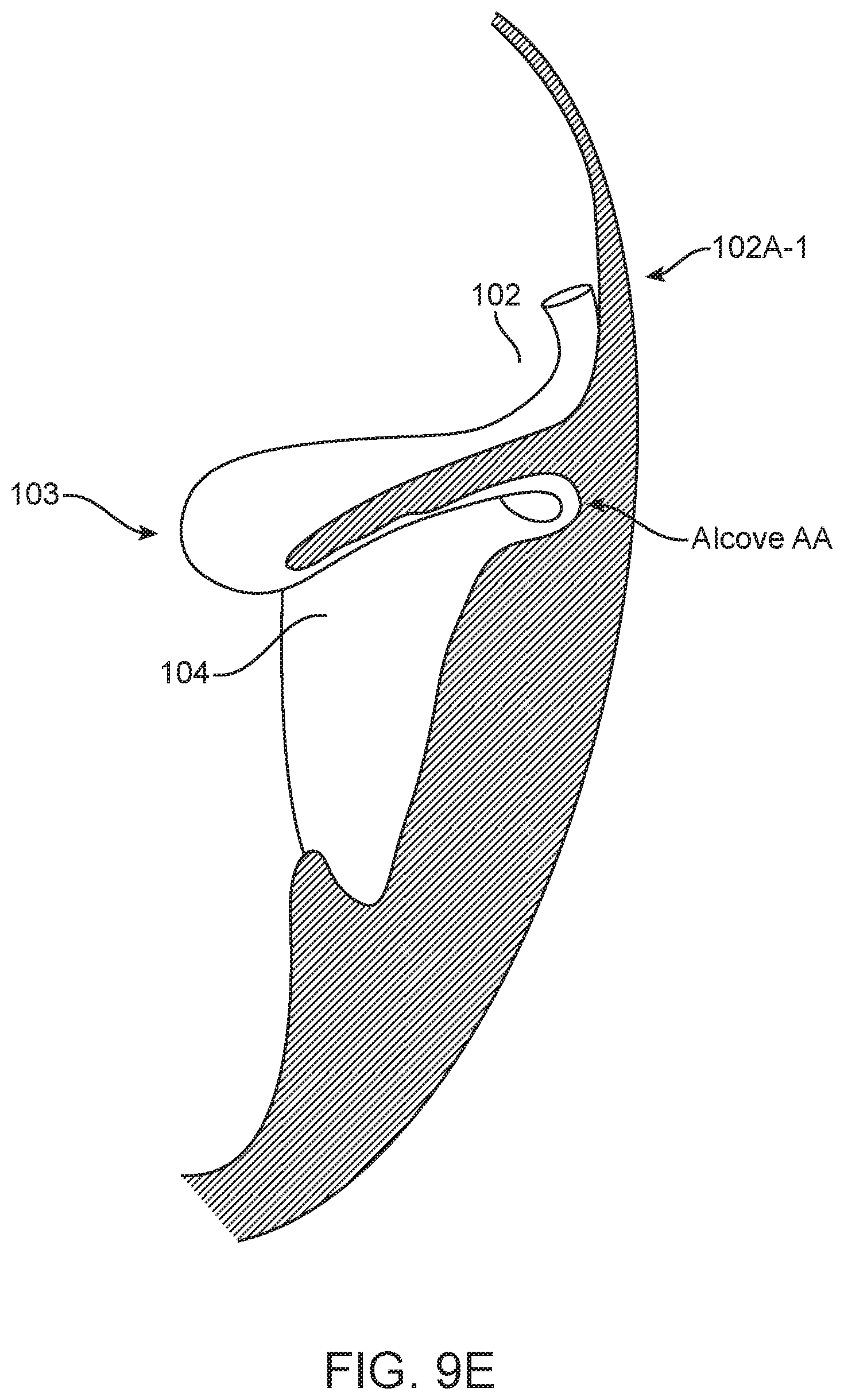 Patent US12616575 Figure 15 – Leaflet extension for cardiac valve leaflet