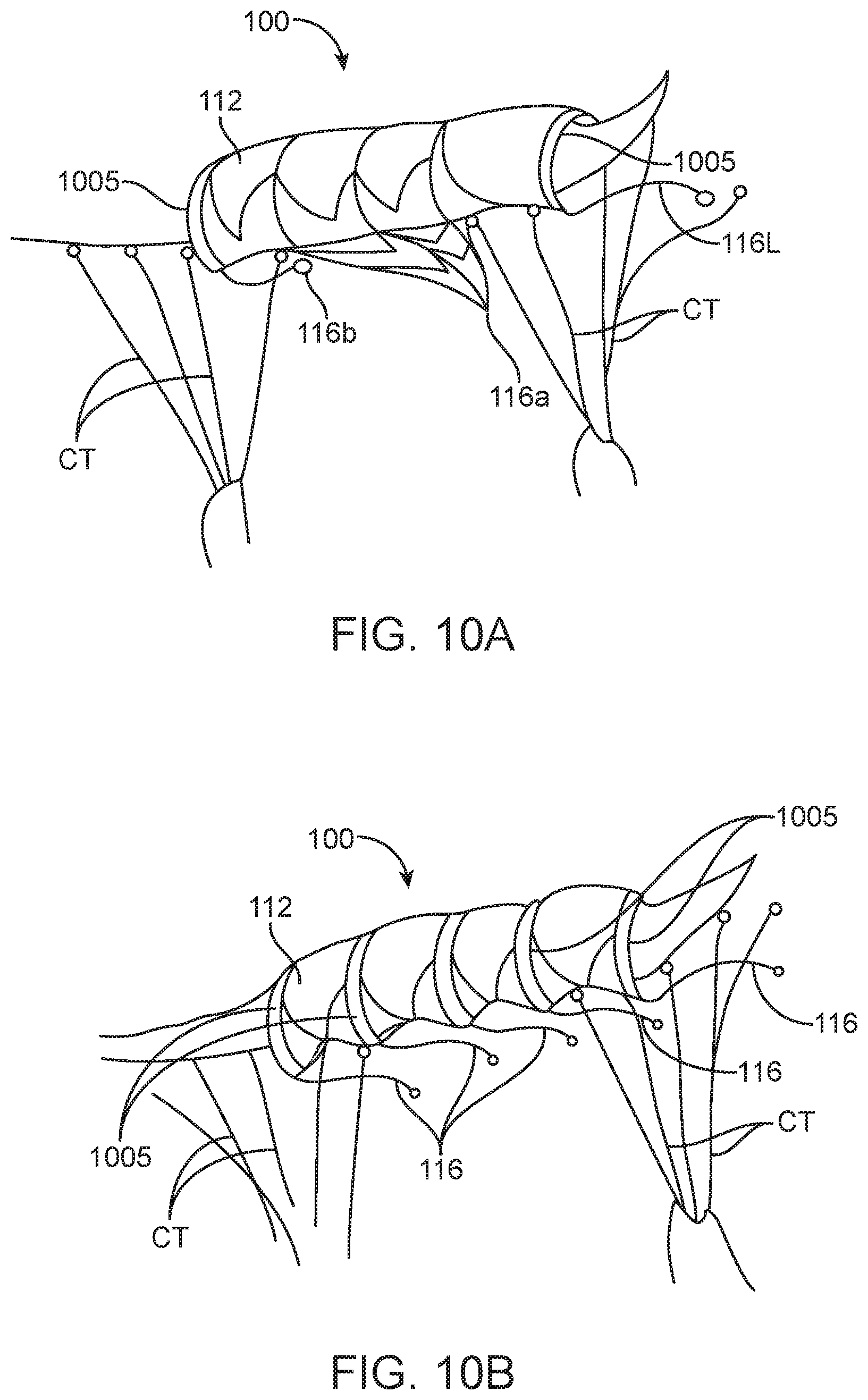 Patent US12616575 Figure 16 – Leaflet extension for cardiac valve leaflet