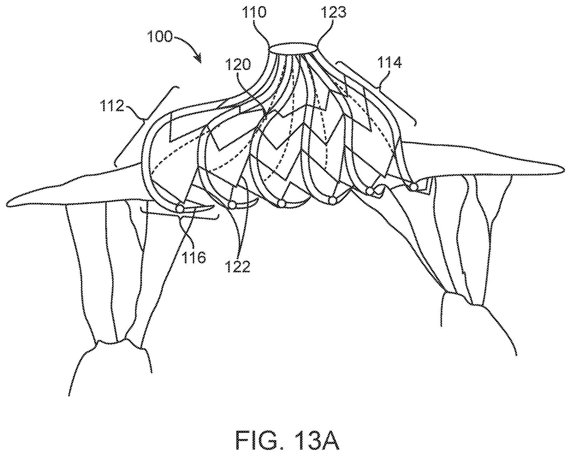 Patent US12616575 Figure 19 – Leaflet extension for cardiac valve leaflet